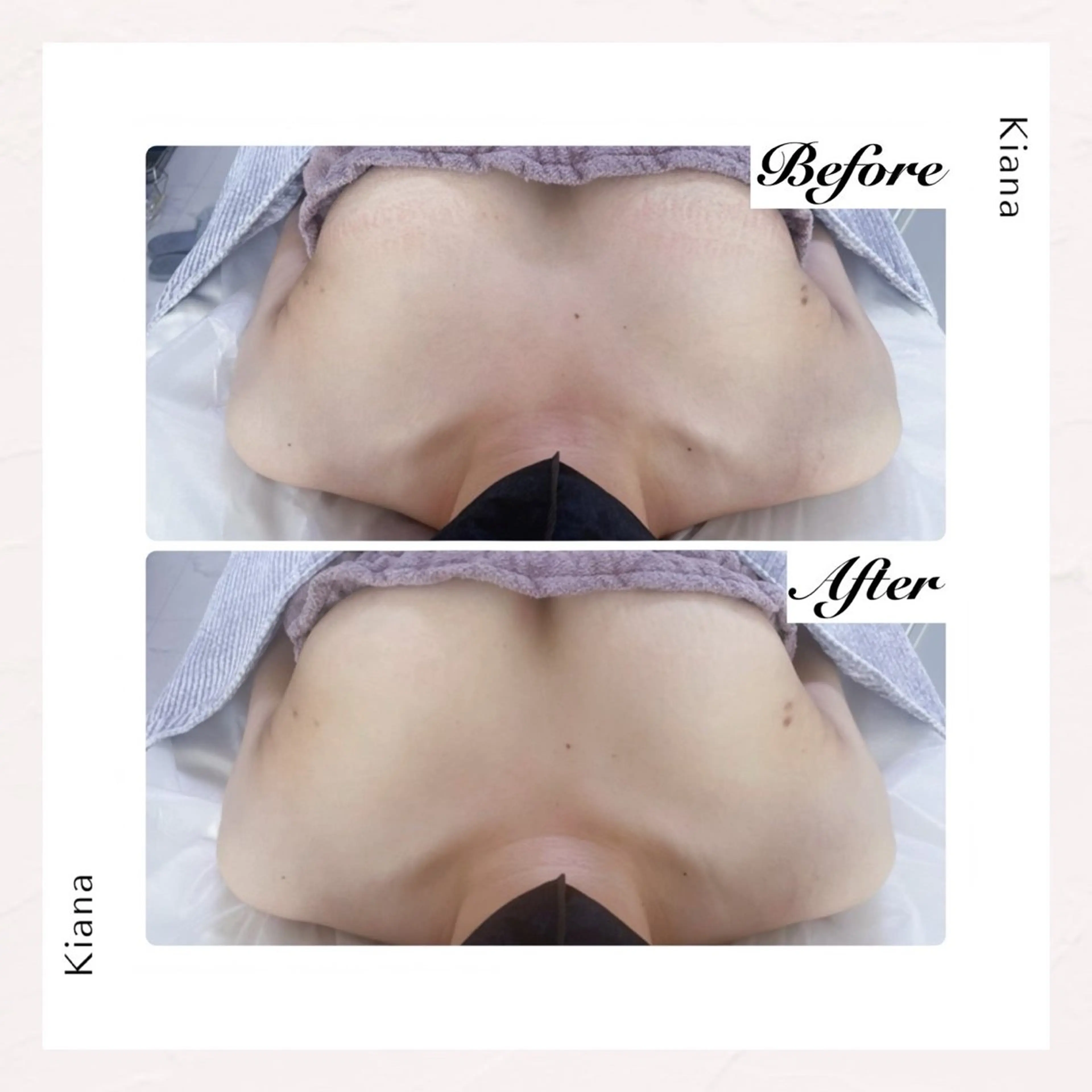 バスト専門Kiana 風のエステ・リラクイメージ