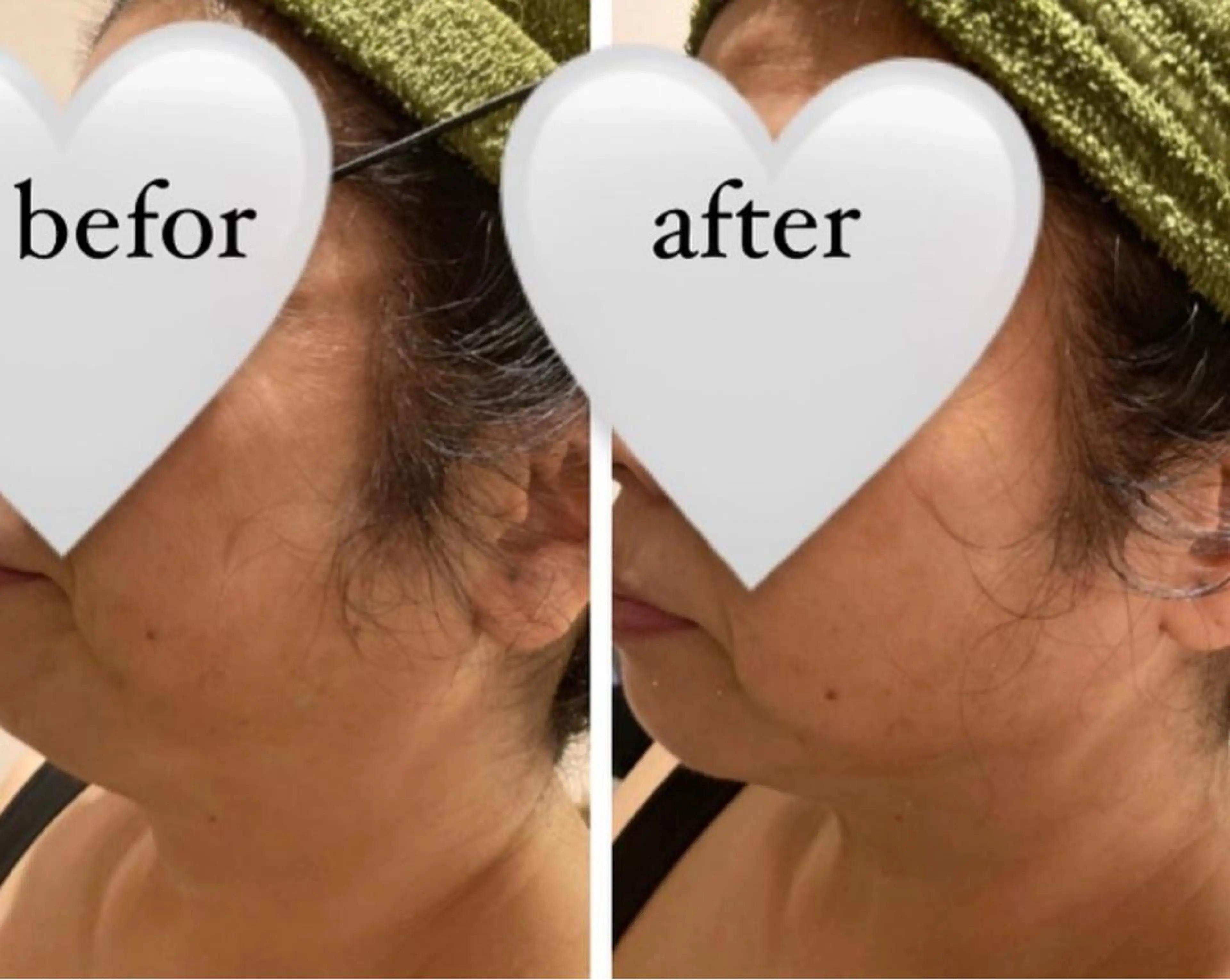 hair&spa tonchi所属・Esthetic MANAMIのエステ・リラクイメージ