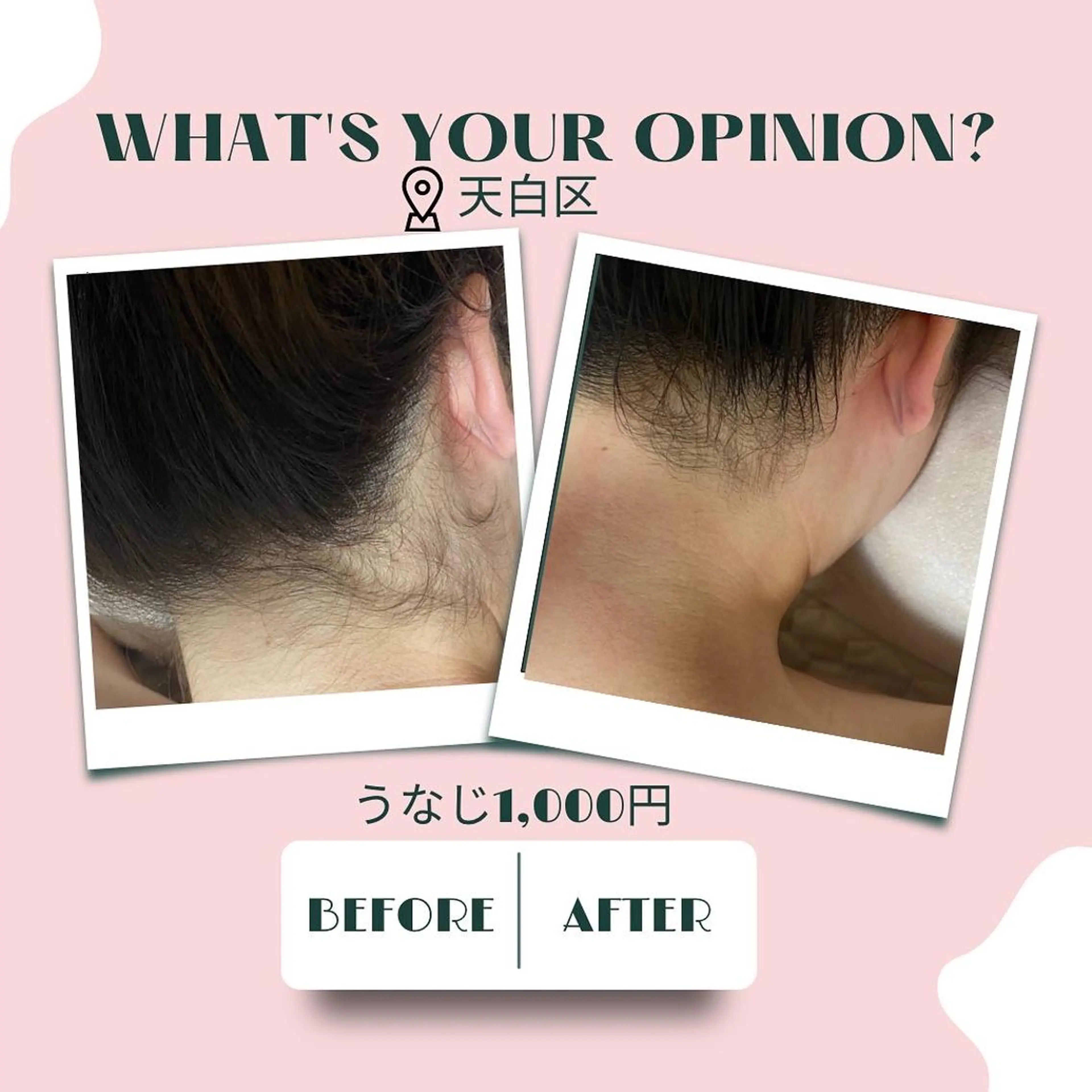 キッズ 脱毛 🌈松 本🌈のエステ・リラクイメージ