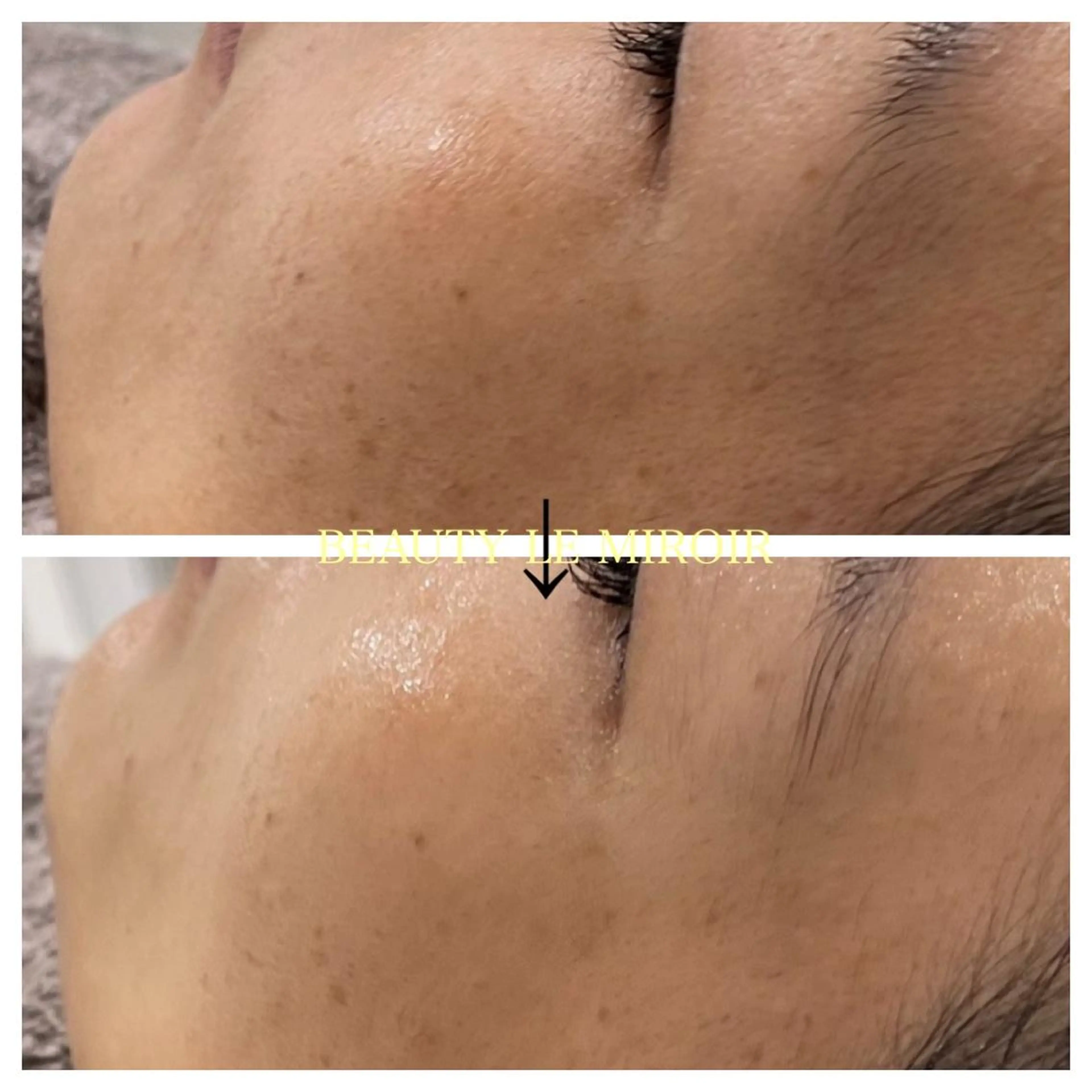 マツエク・マツパ ビューティー ミロワールのエステ・リラクイメージ