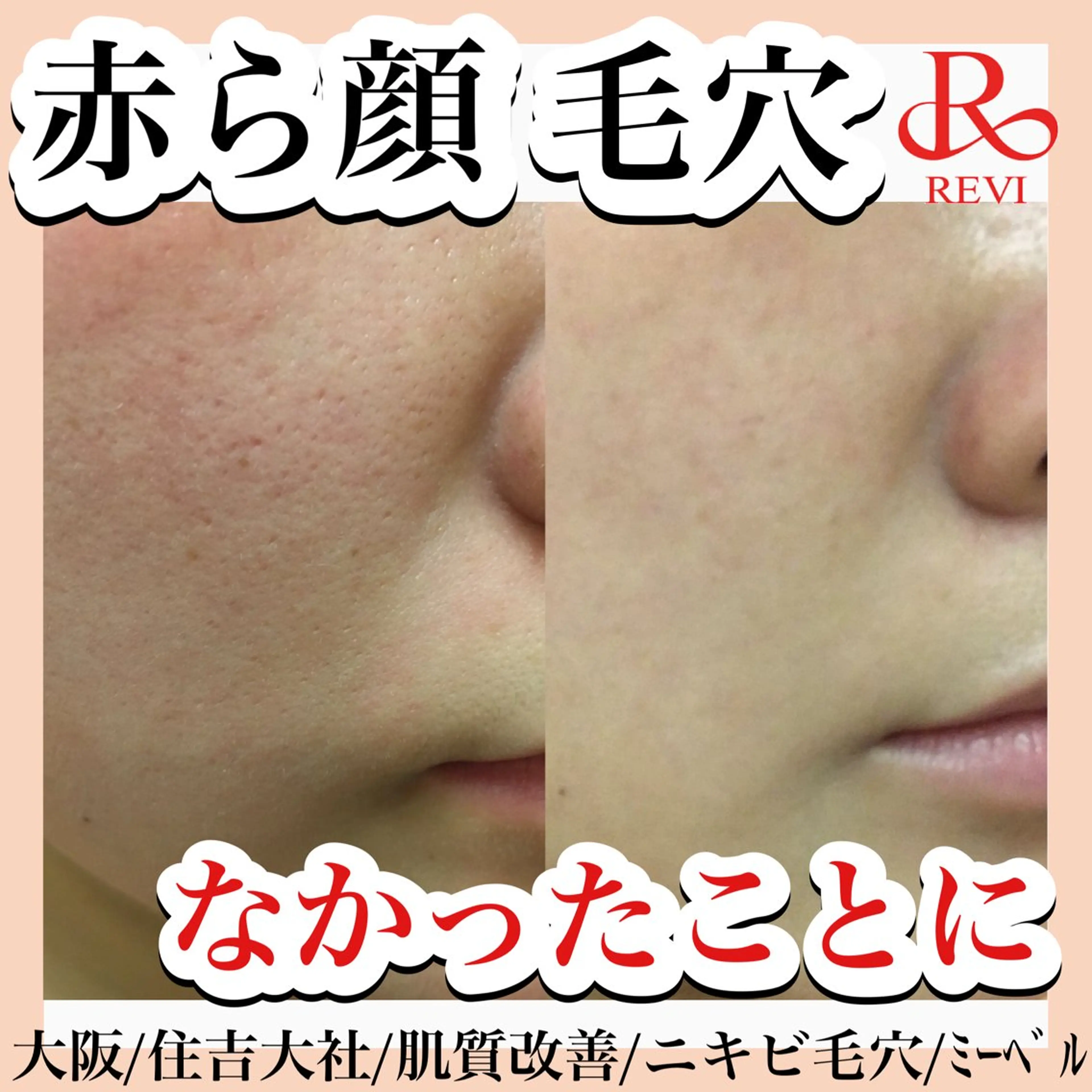 エステ リラク salon  mebell所属・肌管理専門店 mebell天王寺店のエステ・リラクイメージ