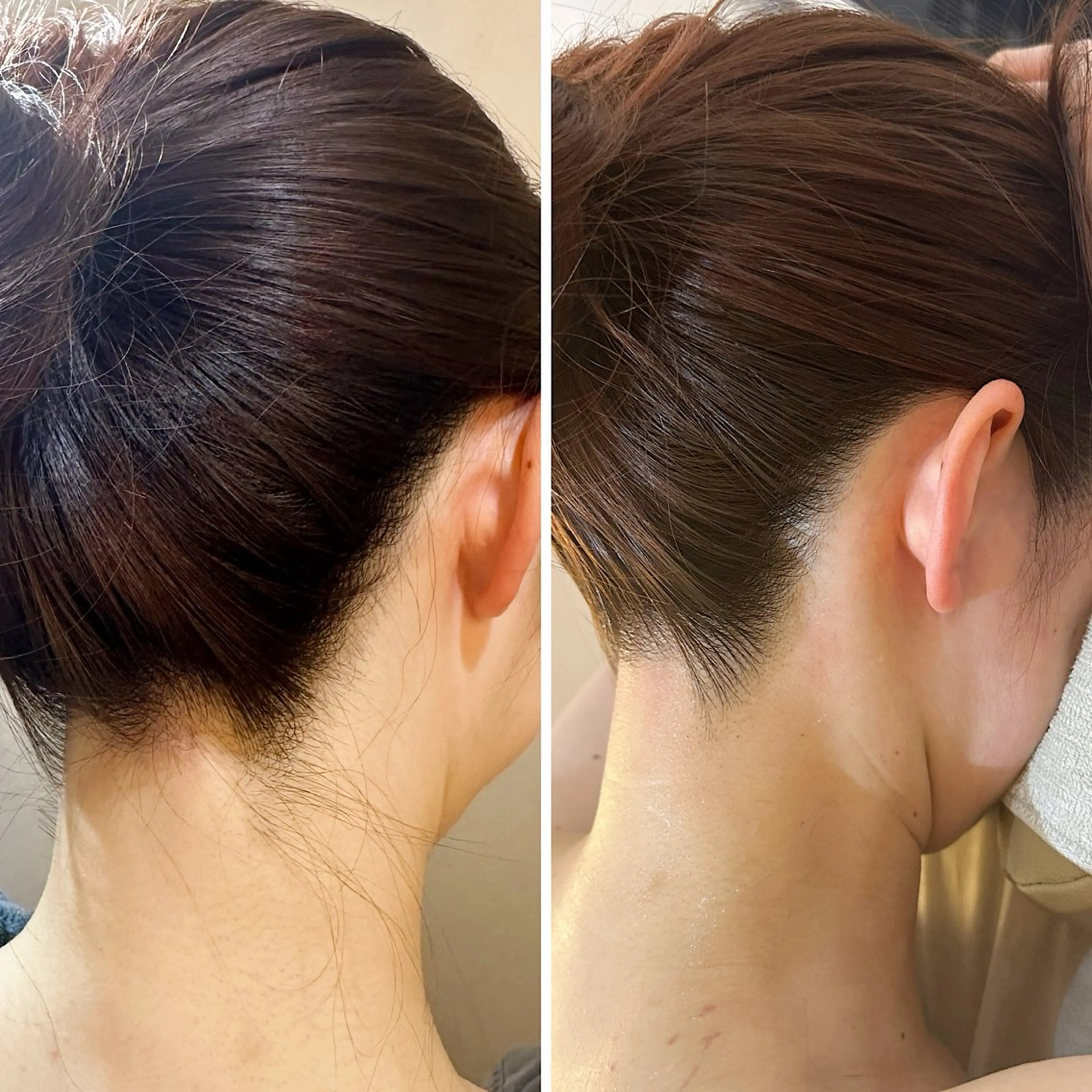 脱毛 うなじ脱毛/美肌脱毛 LABELのエステ・リラクイメージ