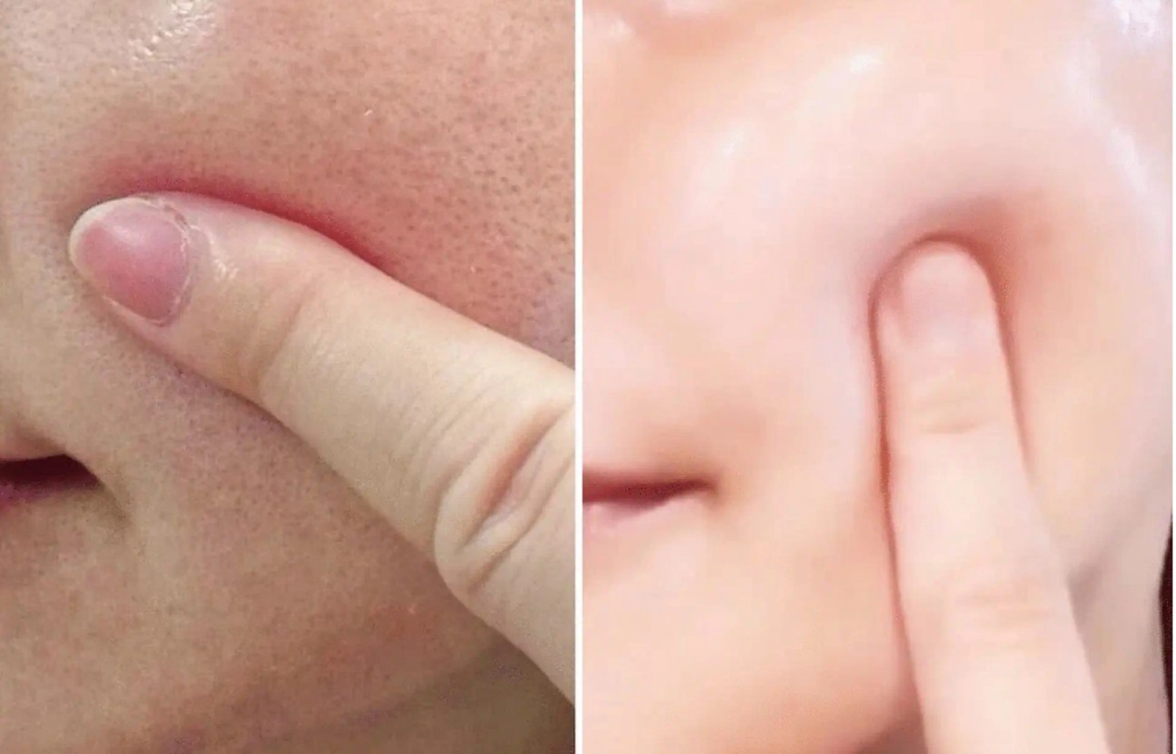 マツエク・マツパ エステ aliaハイフ&水光ジェットサロン所属・aliaハーブ水光店 エステティシャン募集のエステ・リラクイメージ