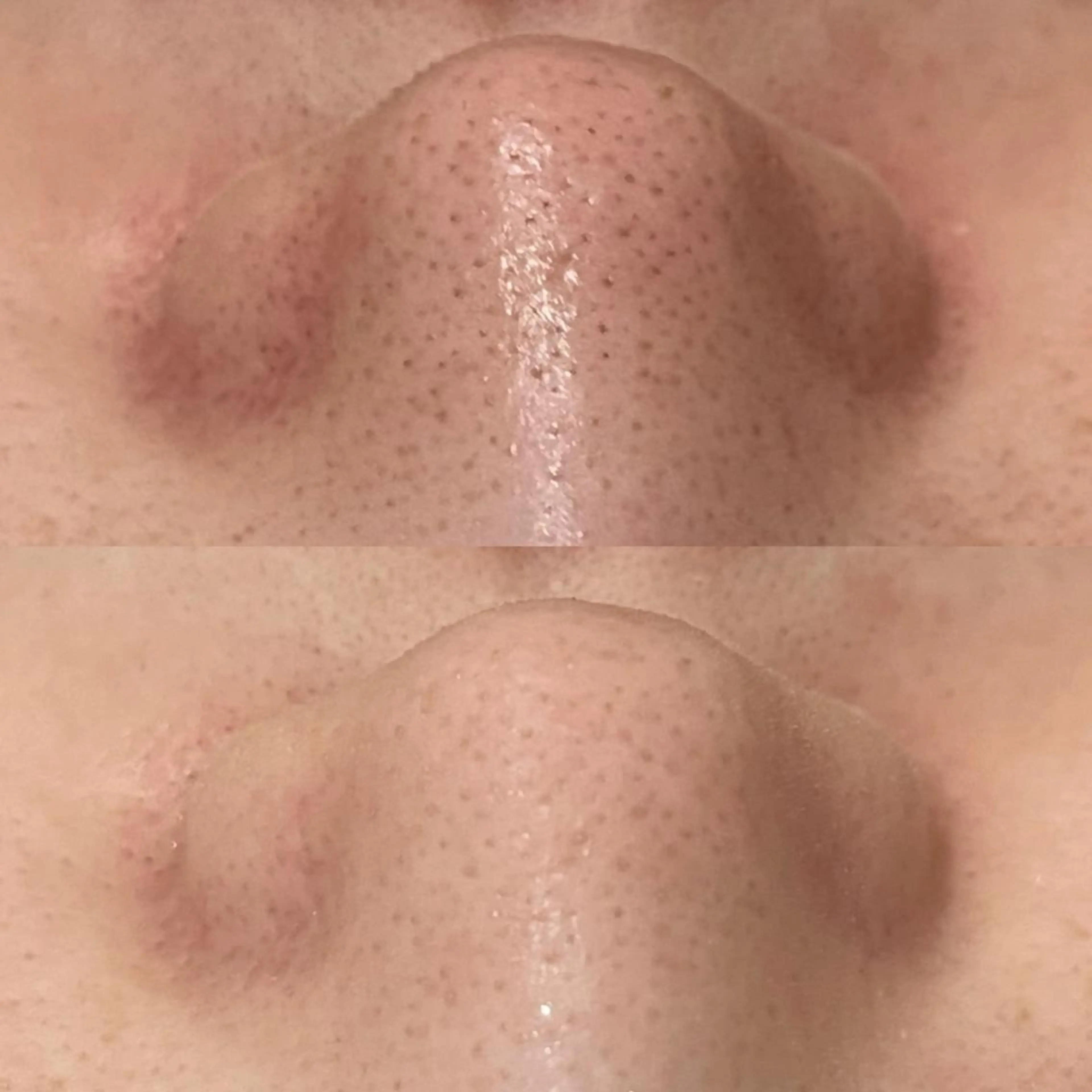 ニキビ・肌質改善専門 ♡人生が変わるサロンのエステ・リラクイメージ