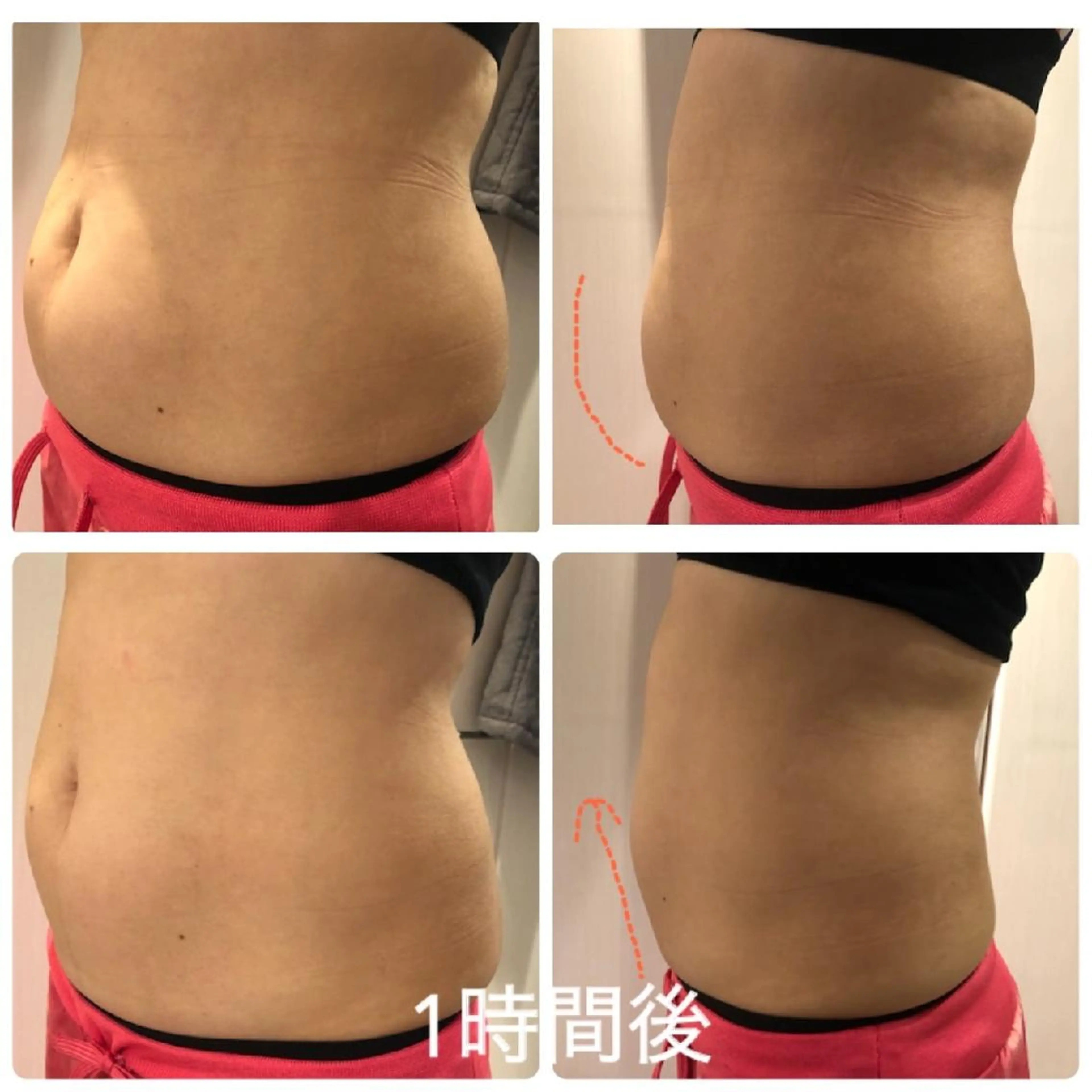 ロゼ ブランシュのエステ・リラクイメージ