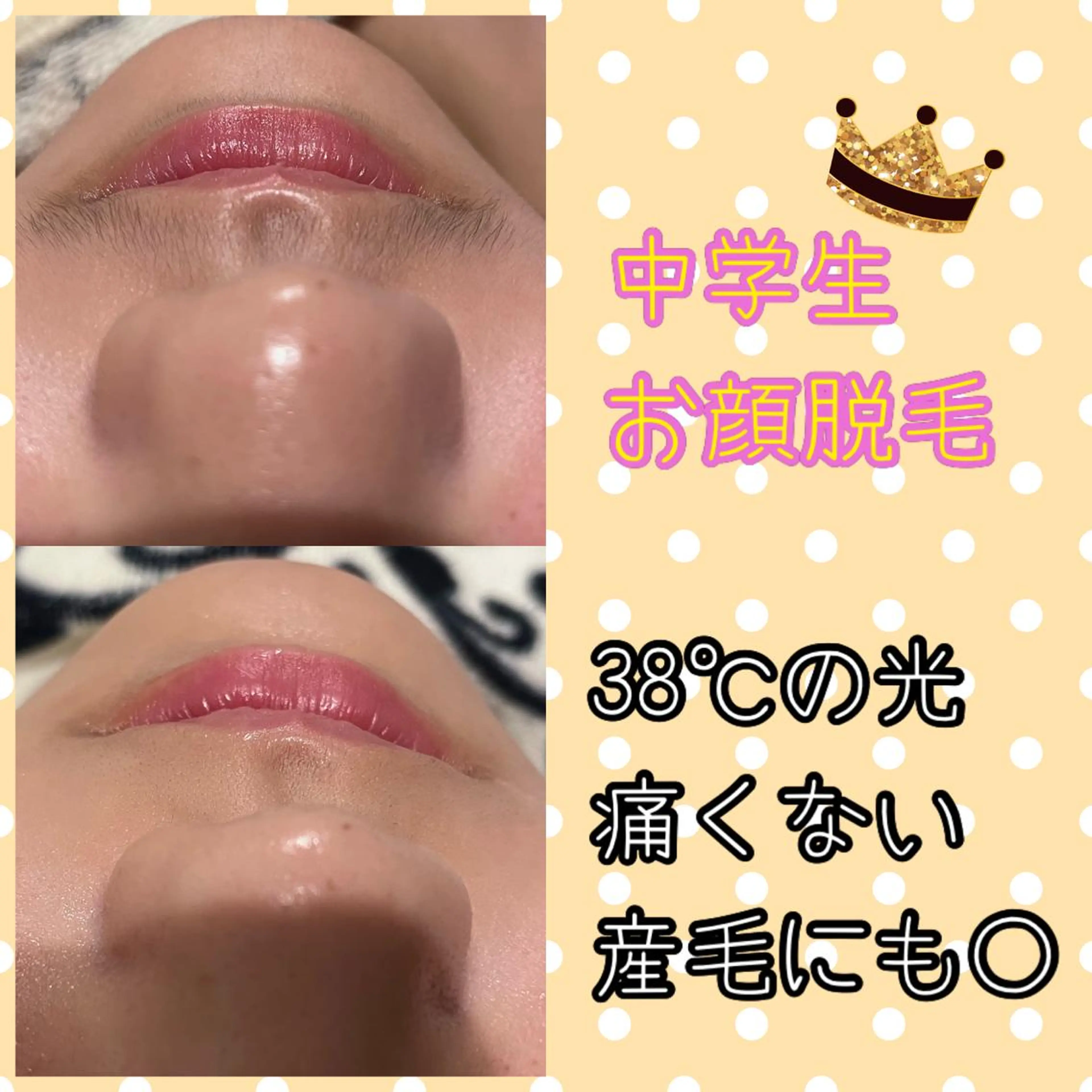 キッズ 脱毛 Dione八王子店所属・LUKE （ルーク）のエステ・リラクイメージ