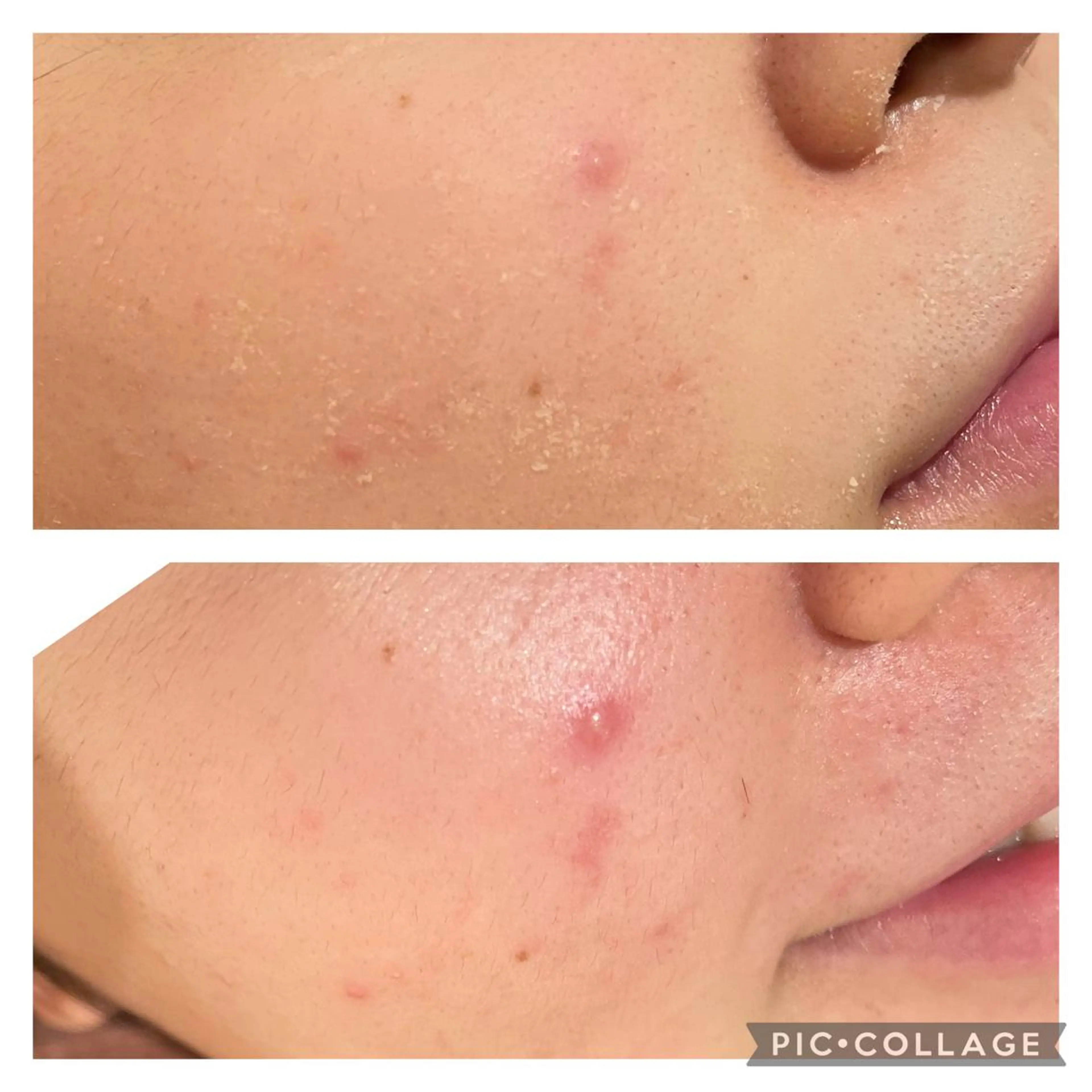 セミロング カラー パーマ ヘアアレンジ メンズ キッズ ネイル マツエク・マツパ ニキビ特化型エステ 🍓最短で肌質改善のエステ・リラクイメージ