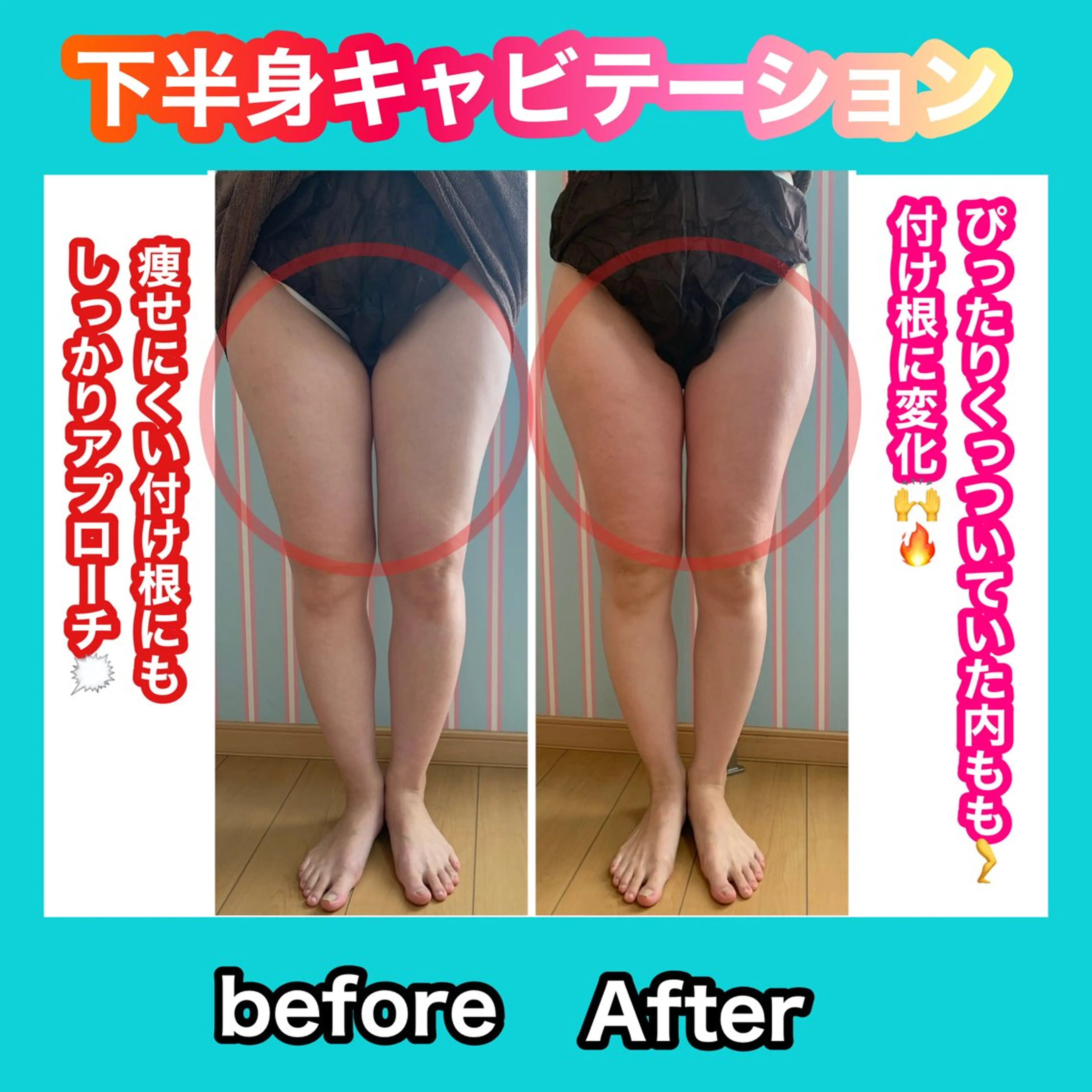 エステ リラク 痩身/脱毛/ネイル HARUKAのエステ・リラクイメージ