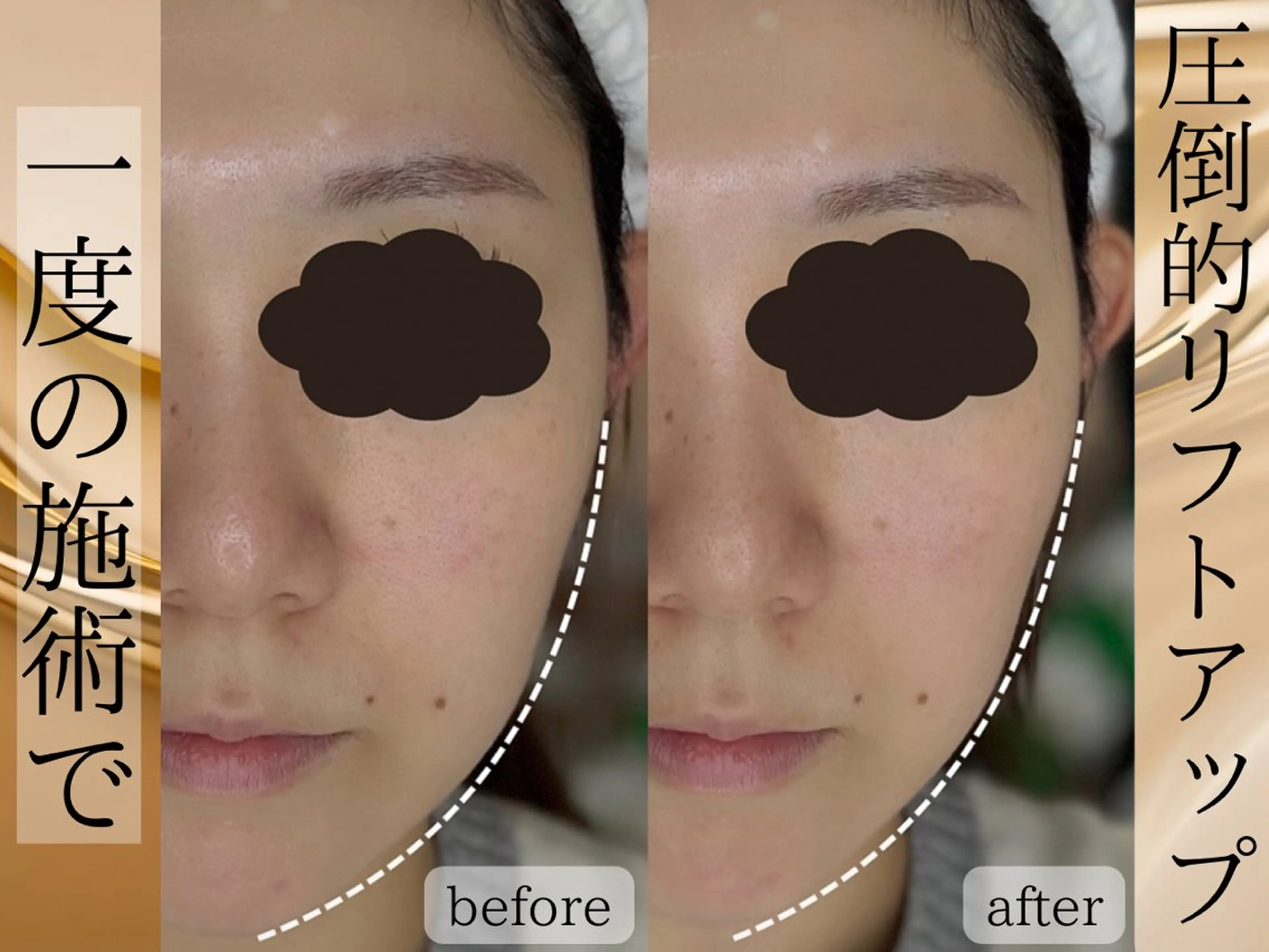 Rairy所属・Rairy Salon富士見町のエステ・リラクイメージ