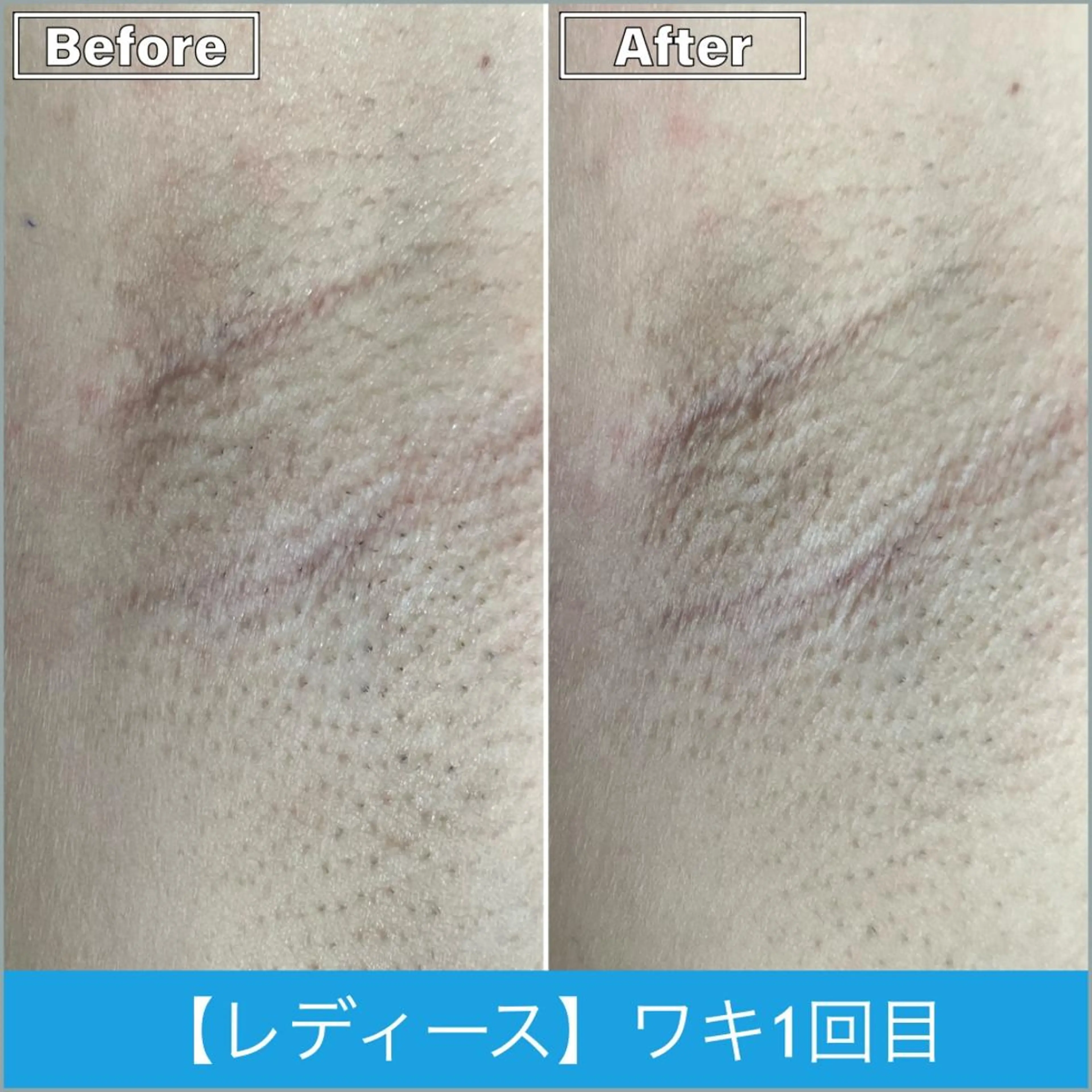 脱毛 プライベートサロンシャルム所属・プライベートサロン シャルムのその他イメージ