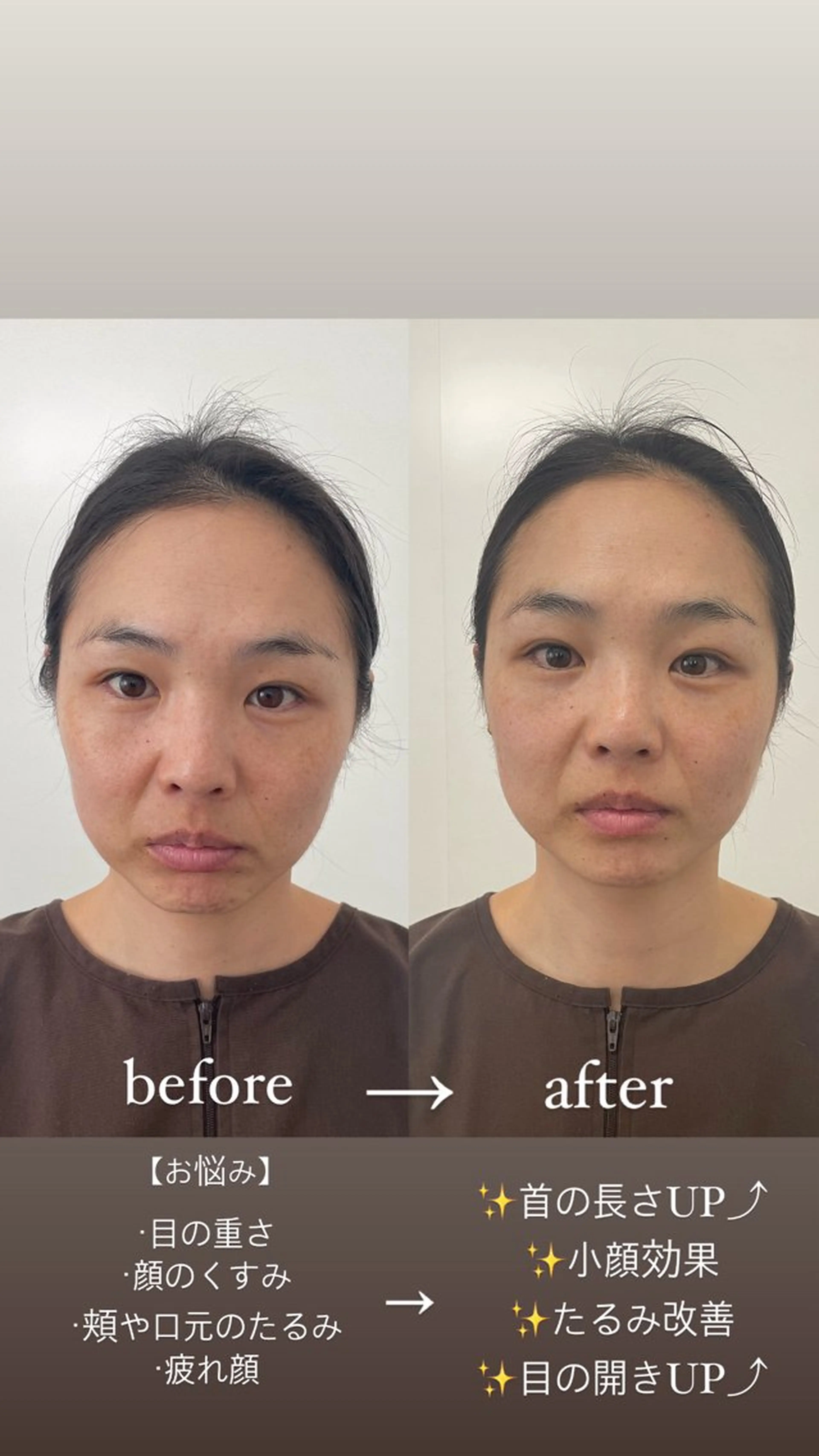 美容鍼・鍼灸専門❤✨ 近藤めぐみのエステ・リラクイメージ