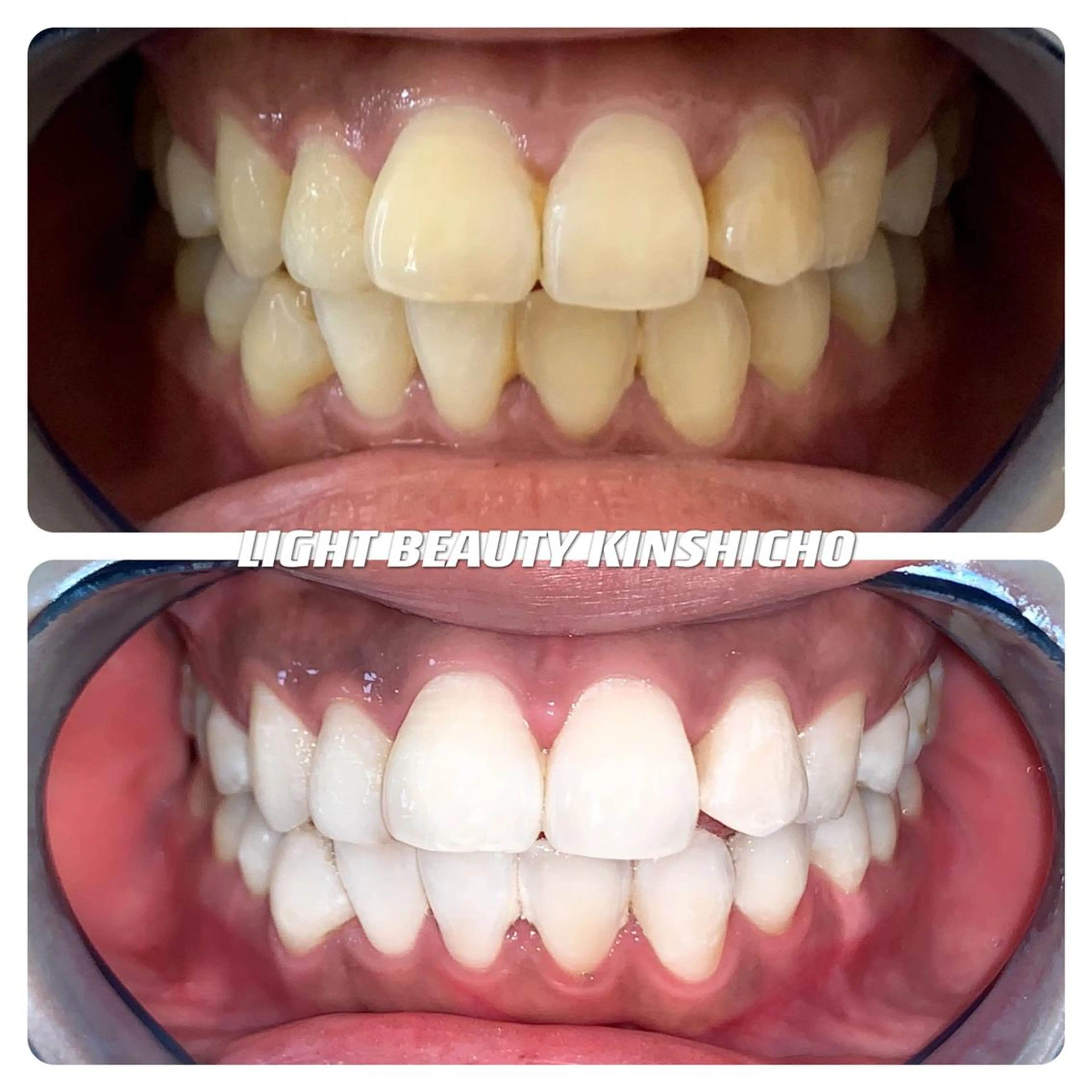 その他 ライトビューティー 錦糸町店のエステ・リラクイメージ