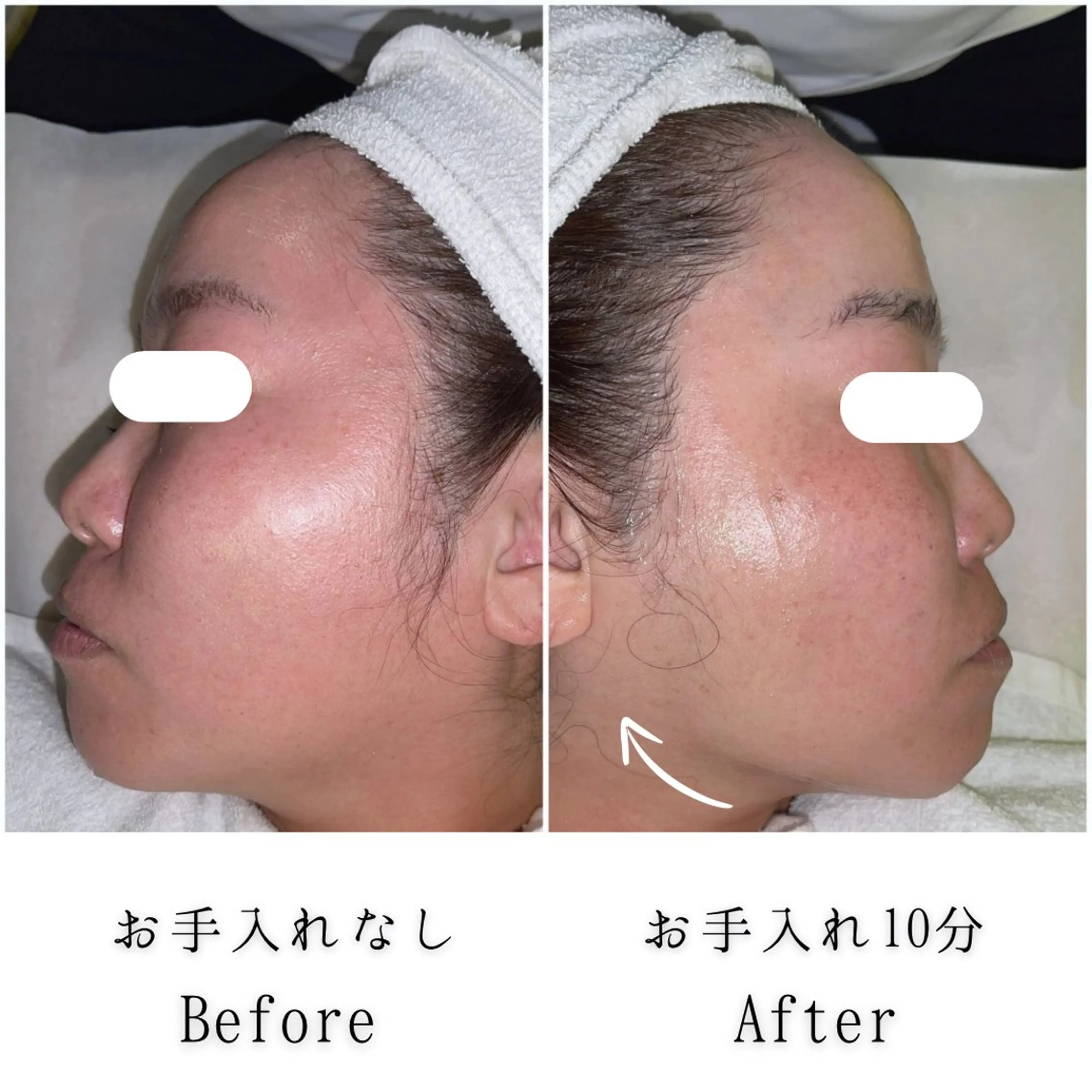 エステ SELF  BEAUTY gracia浦添店所属・gracia 浦添店のその他イメージ