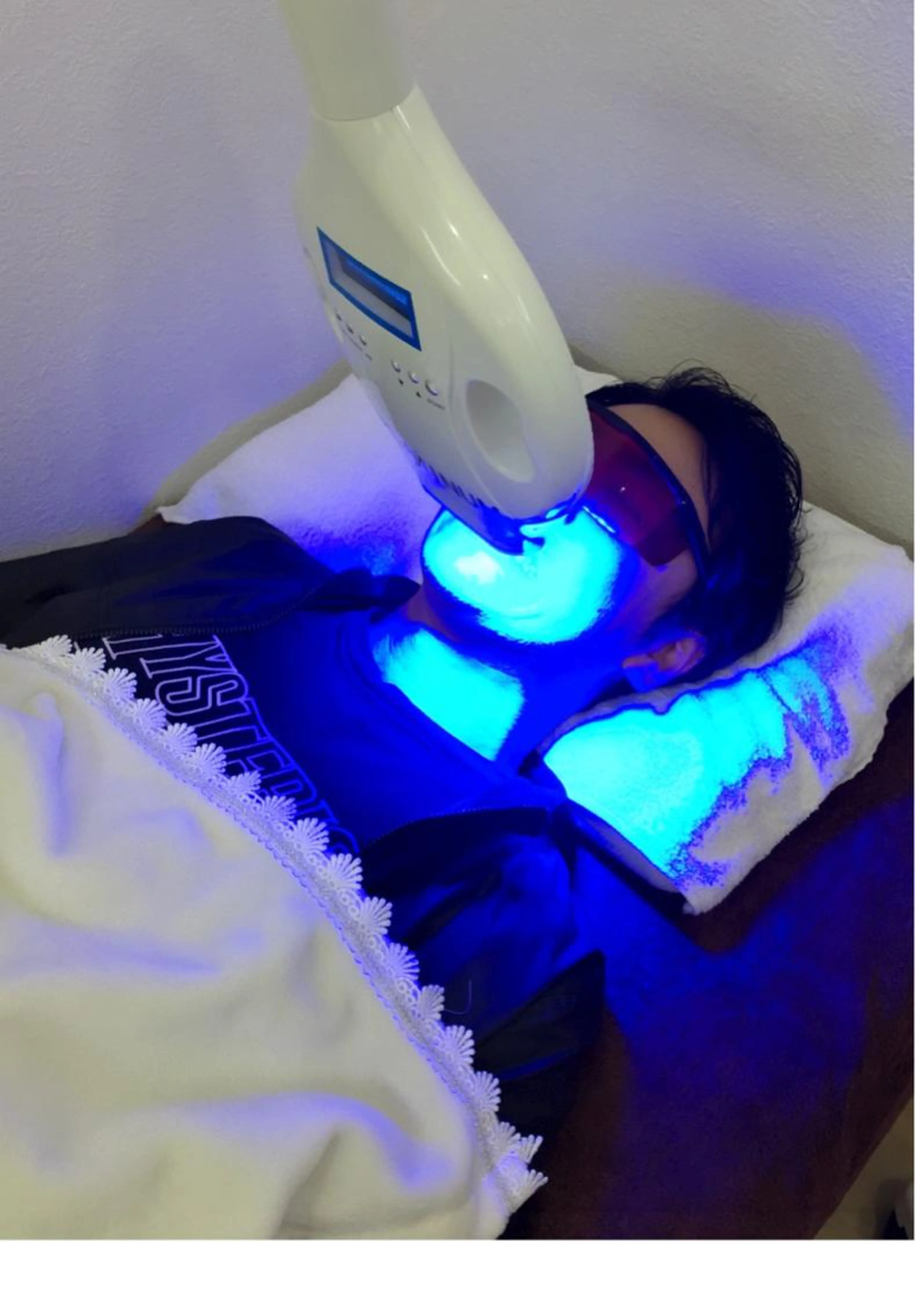 セルフホワイトニング8分照射✨1日完結の写真