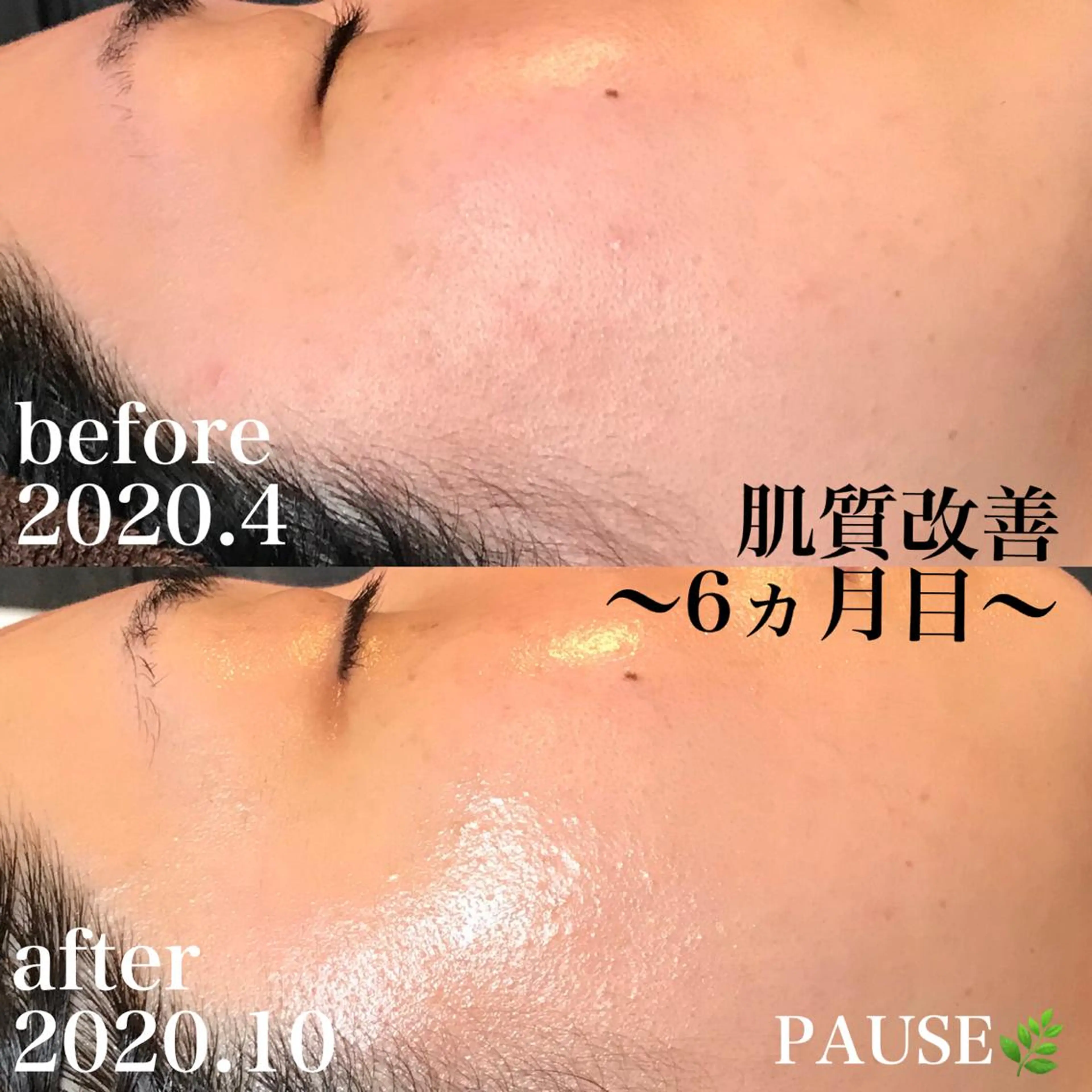 エステ 浜野 恵美のエステ・リラクイメージ