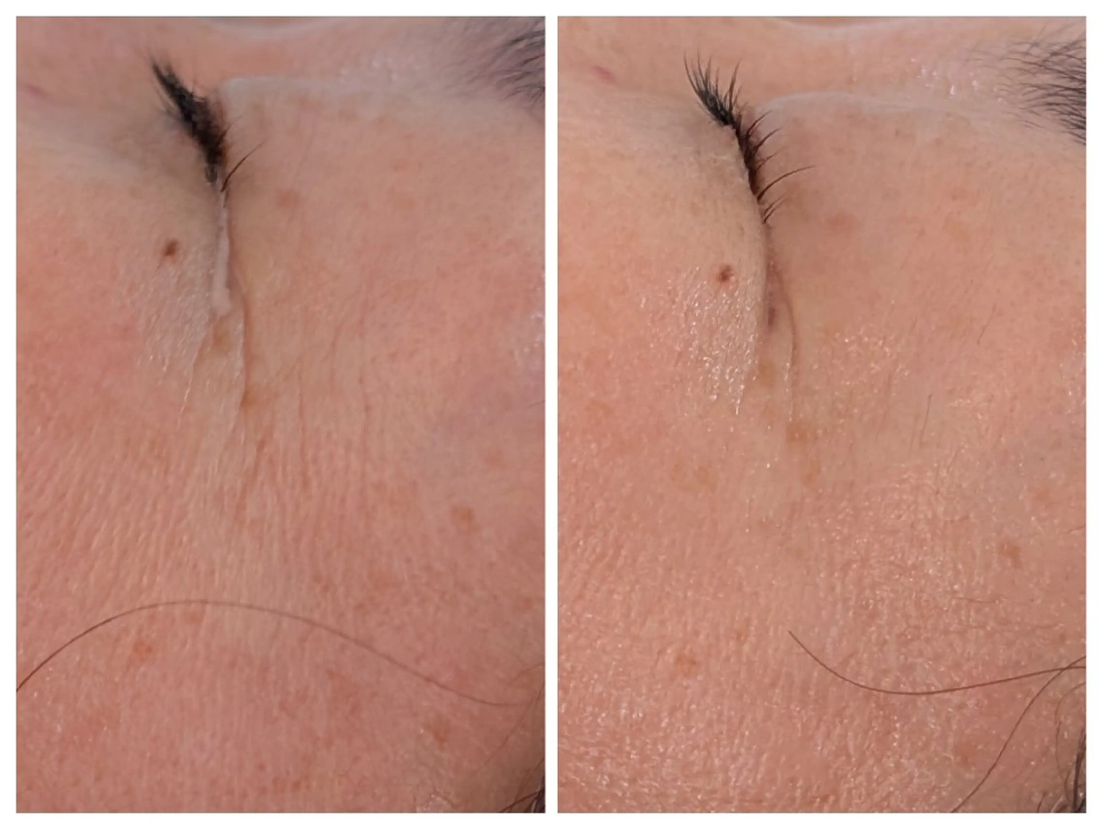 エステ 美肌と小顔のサロン RUVIAのエステ・リラクイメージ