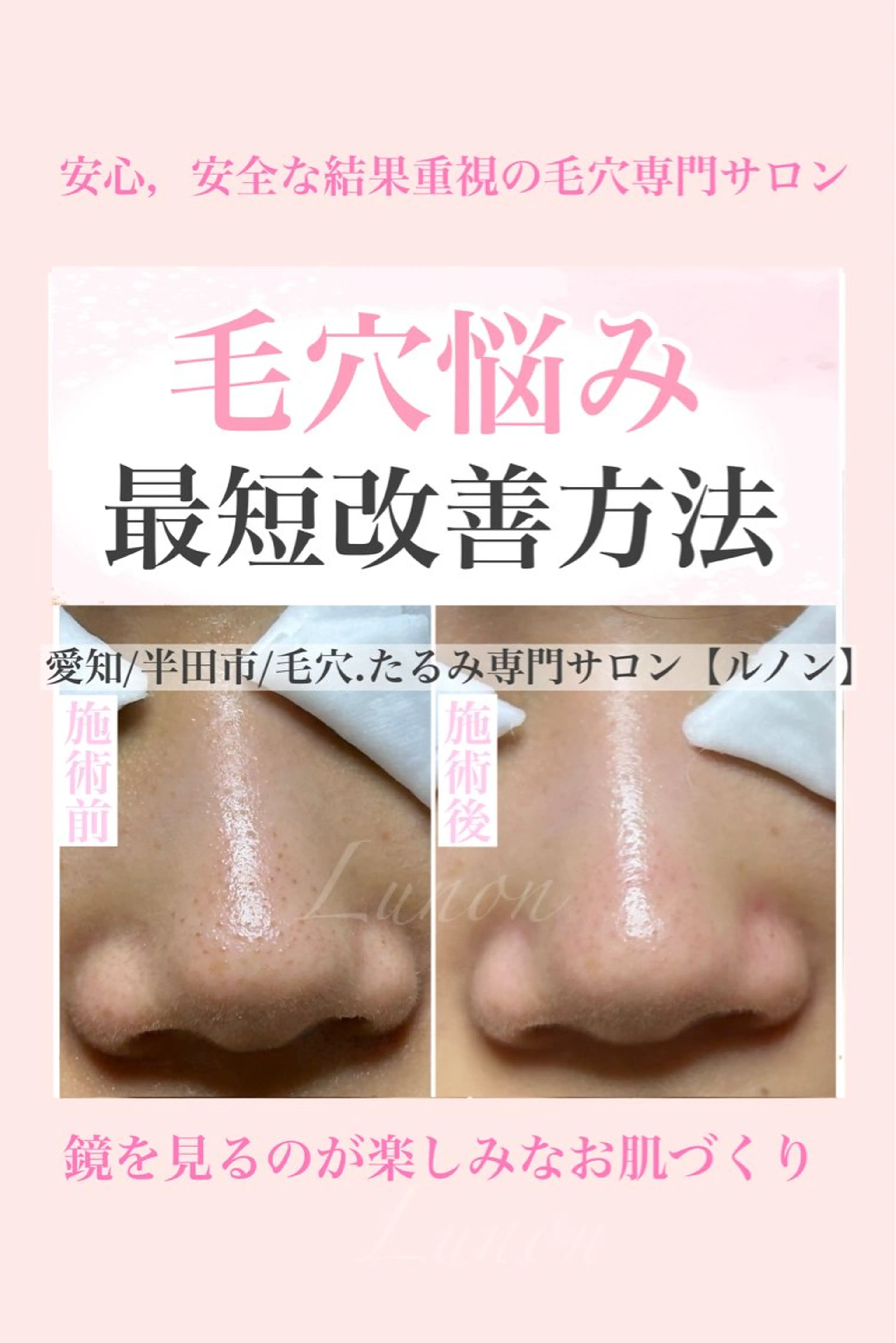 エステ リラク 毛穴.たるみ専門店 Lunonのエステ・リラクイメージ