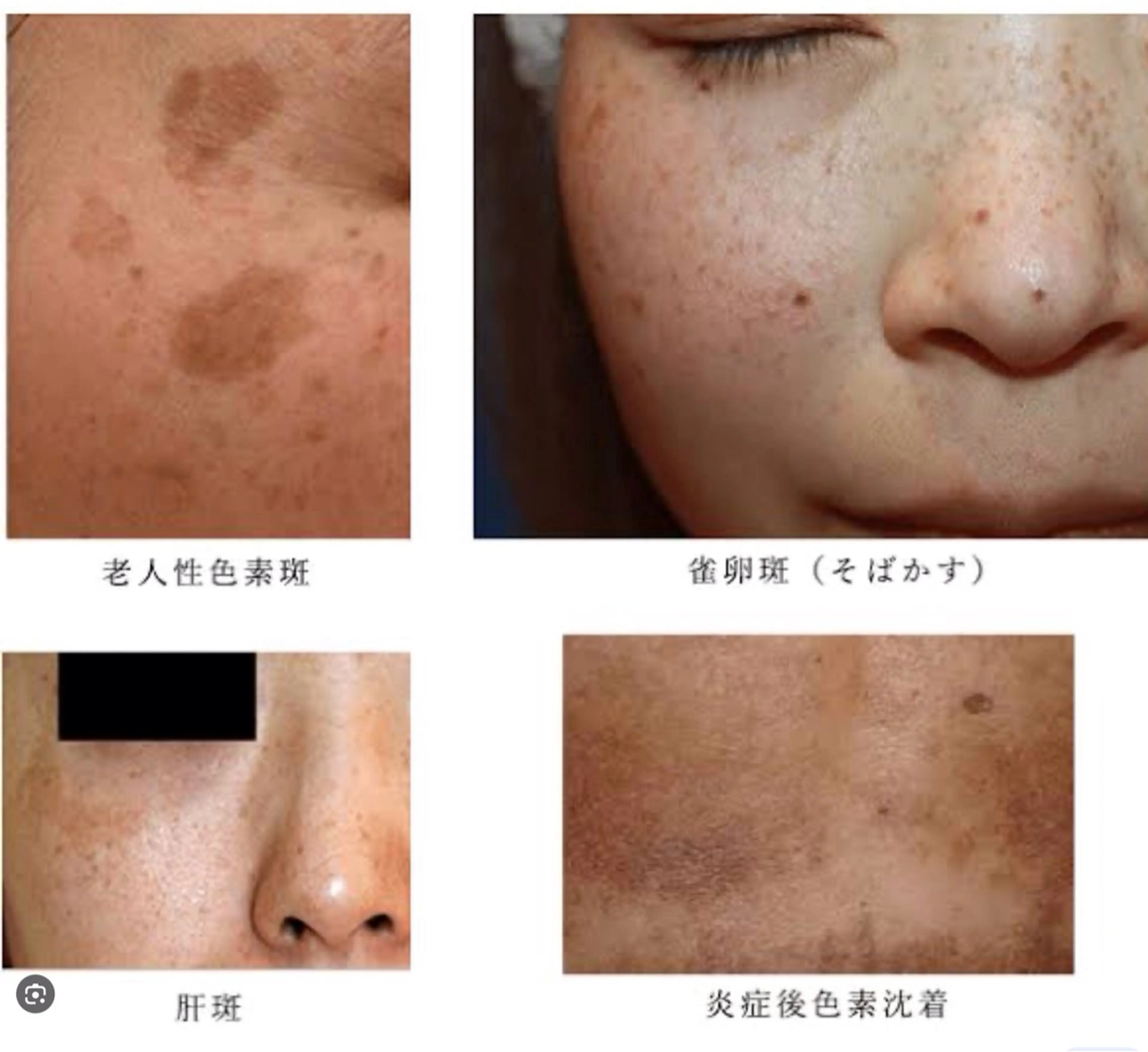 ☺ハーブピール💕 ソフィアカロン💖のエステ・リラクイメージ