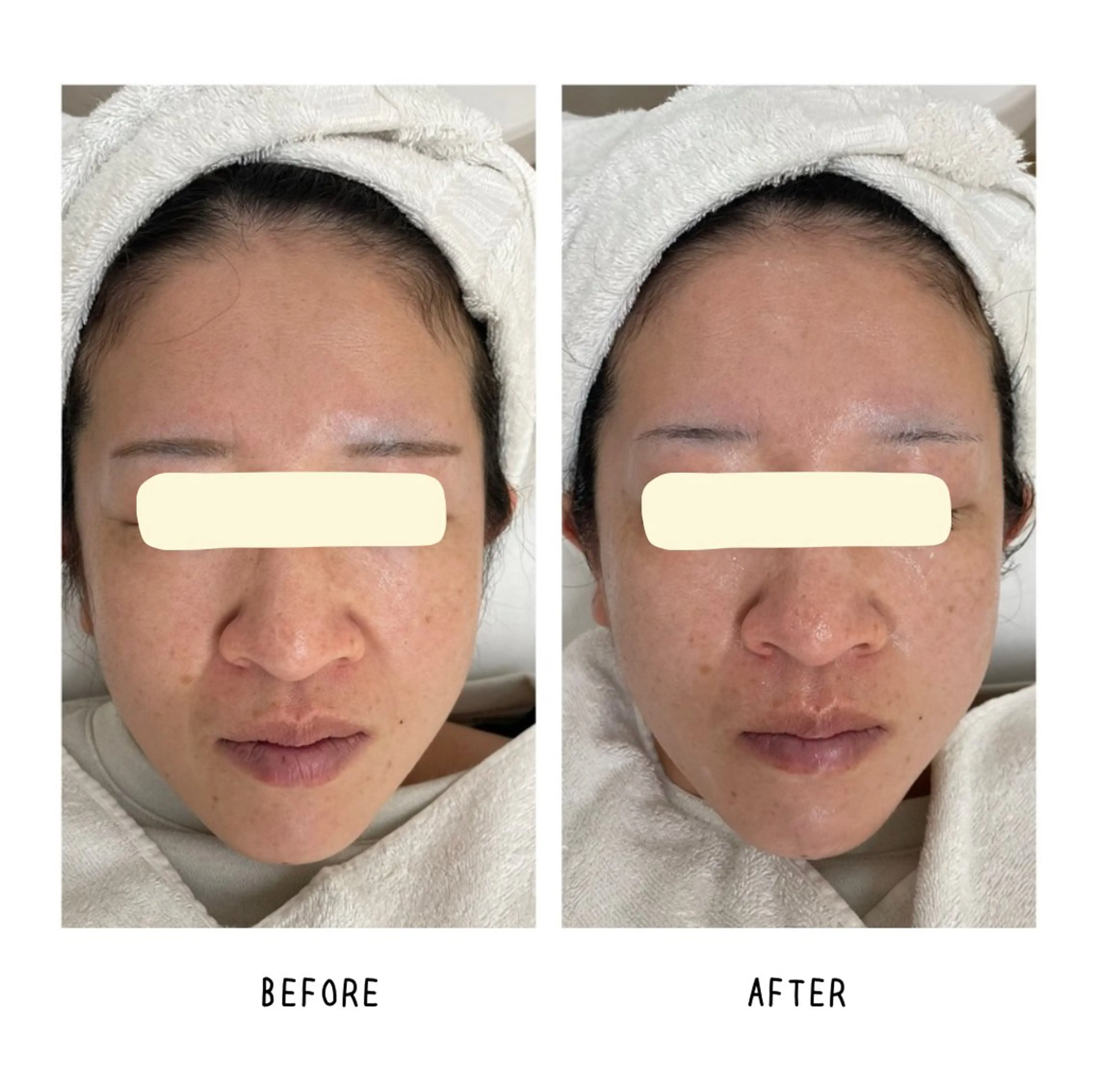 grow所属・Yoshino Erinaのエステ・リラクイメージ