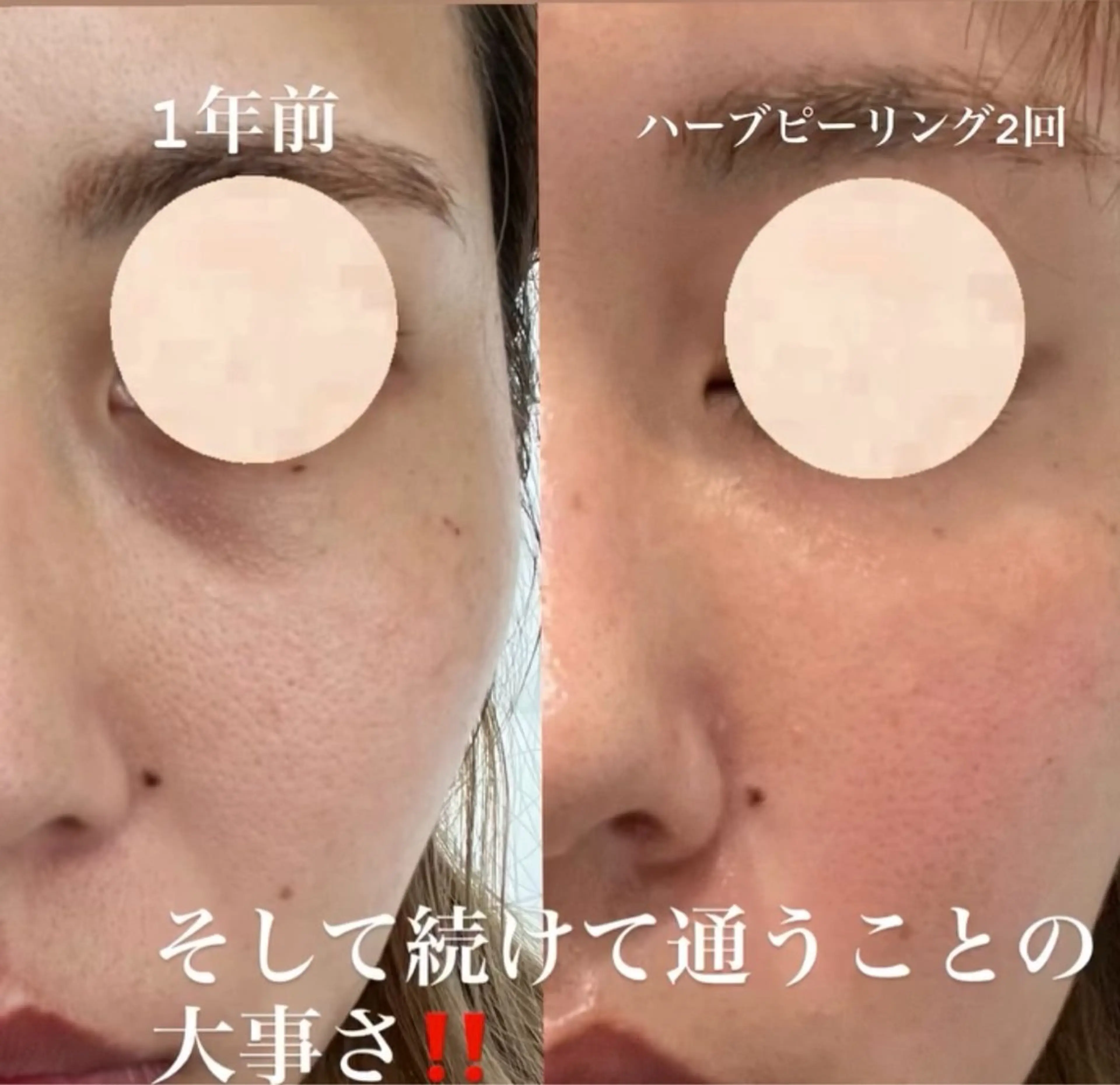 エステ EstheticSalonReTweet所属・竹谷 春希のエステ・リラクイメージ