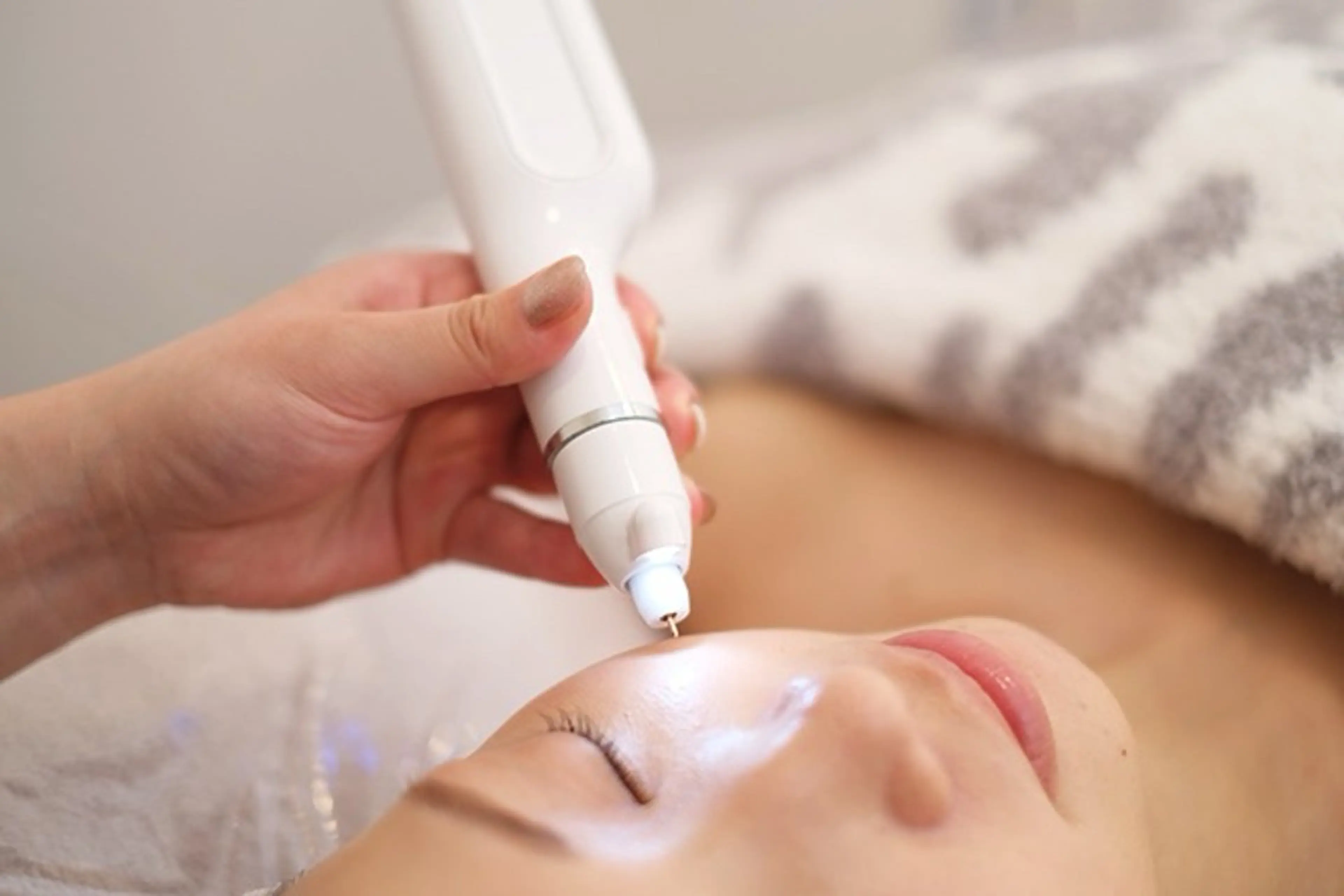 ◇《気になるシミをまとめてケア！》シミケアし放題&プラズマフルコース  90分の写真