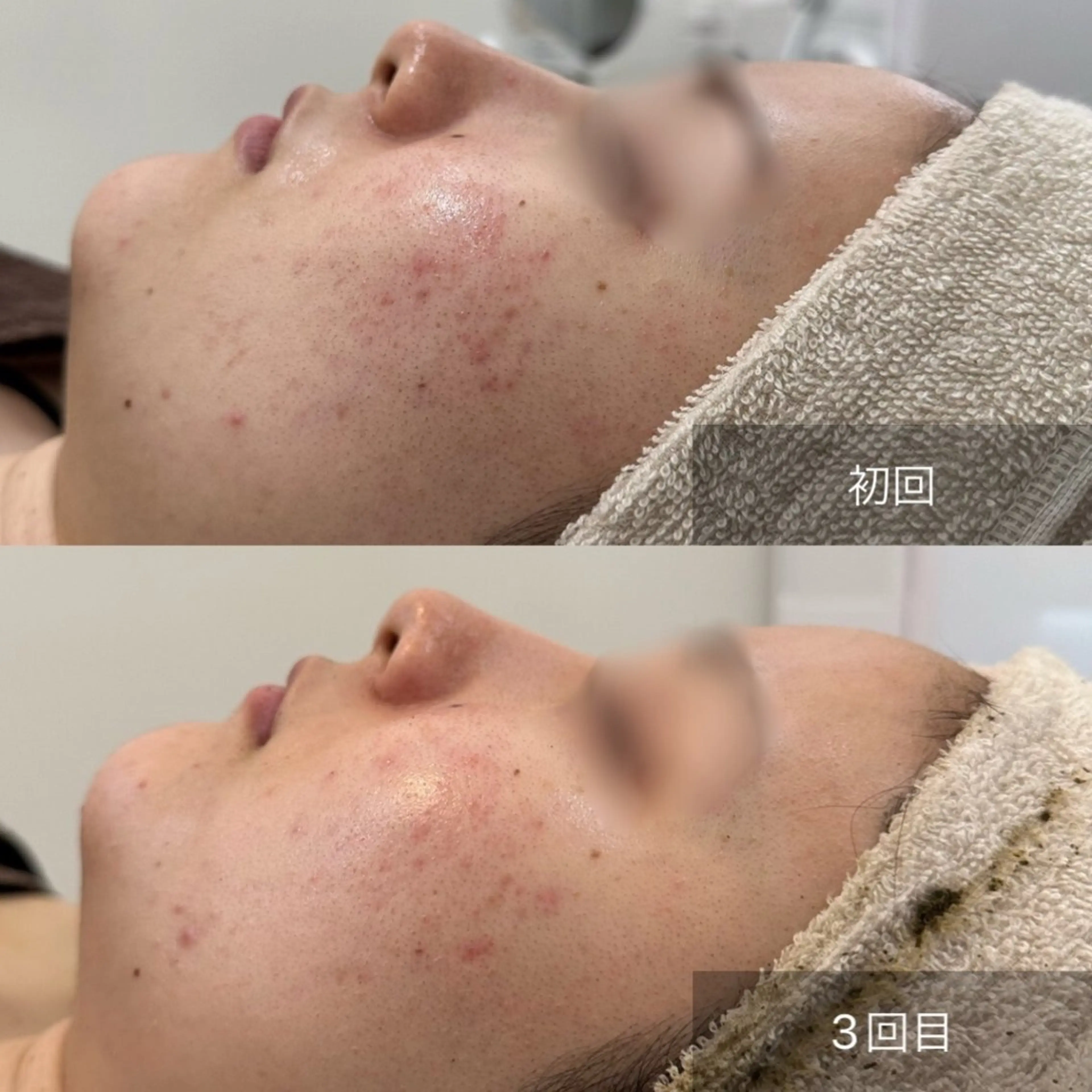 Nicore所属・Nicore NATSUKIのエステ・リラクイメージ