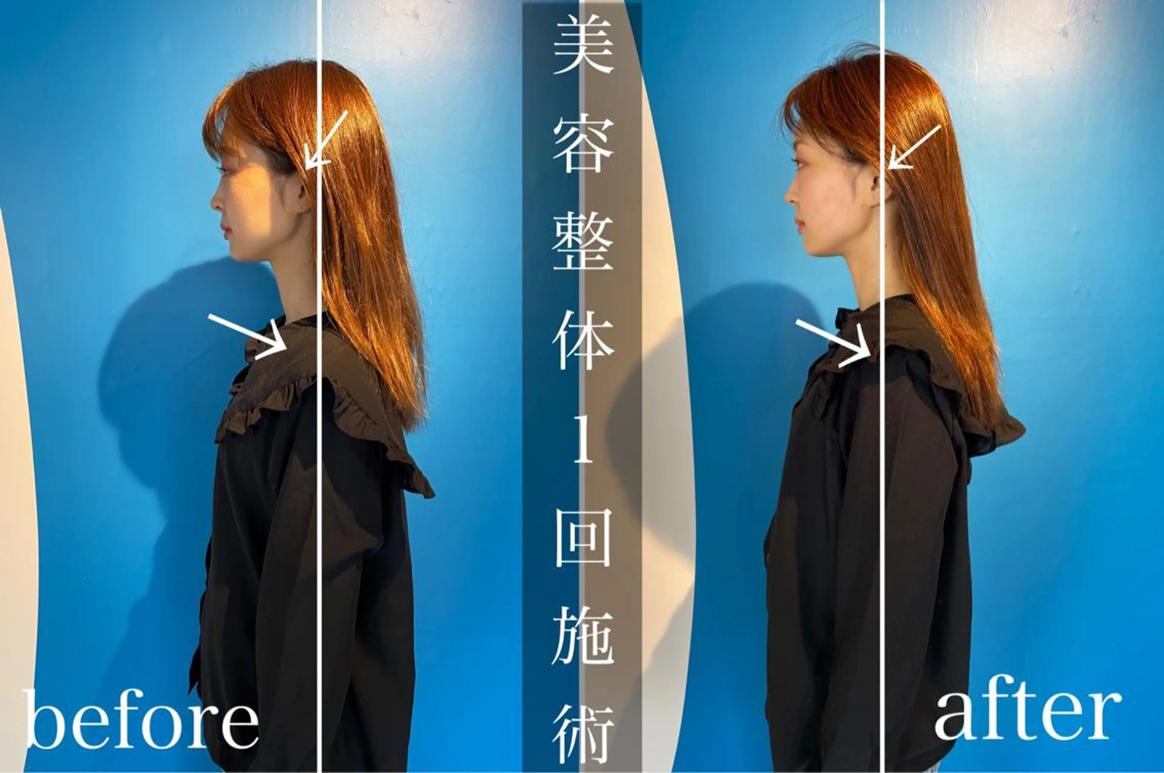 鍼灸整骨院Refine所属・鍼灸 Refineのその他イメージ