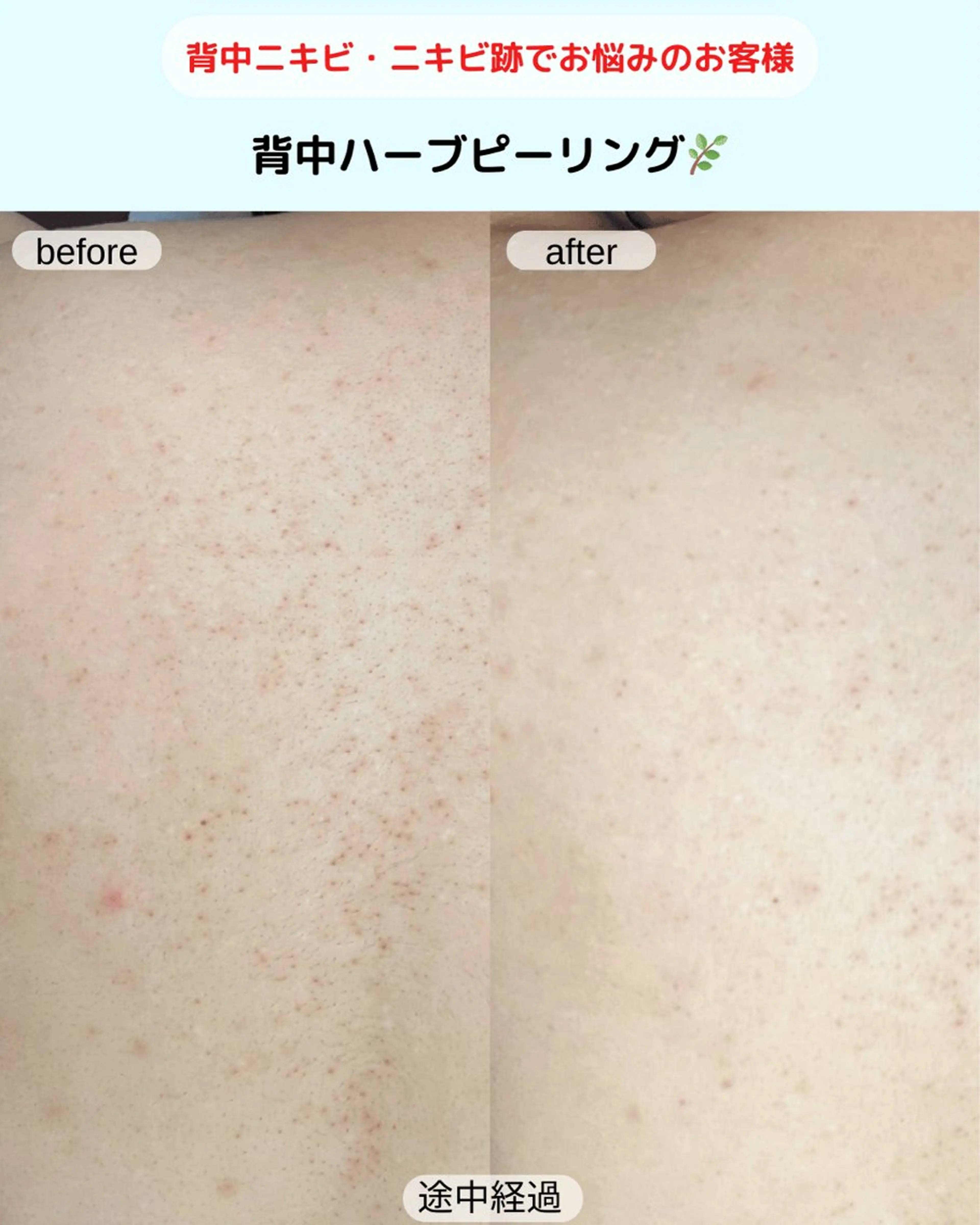 エステ ベラージュ【美背中・ 美尻・フェイシャル】のエステ・リラクイメージ