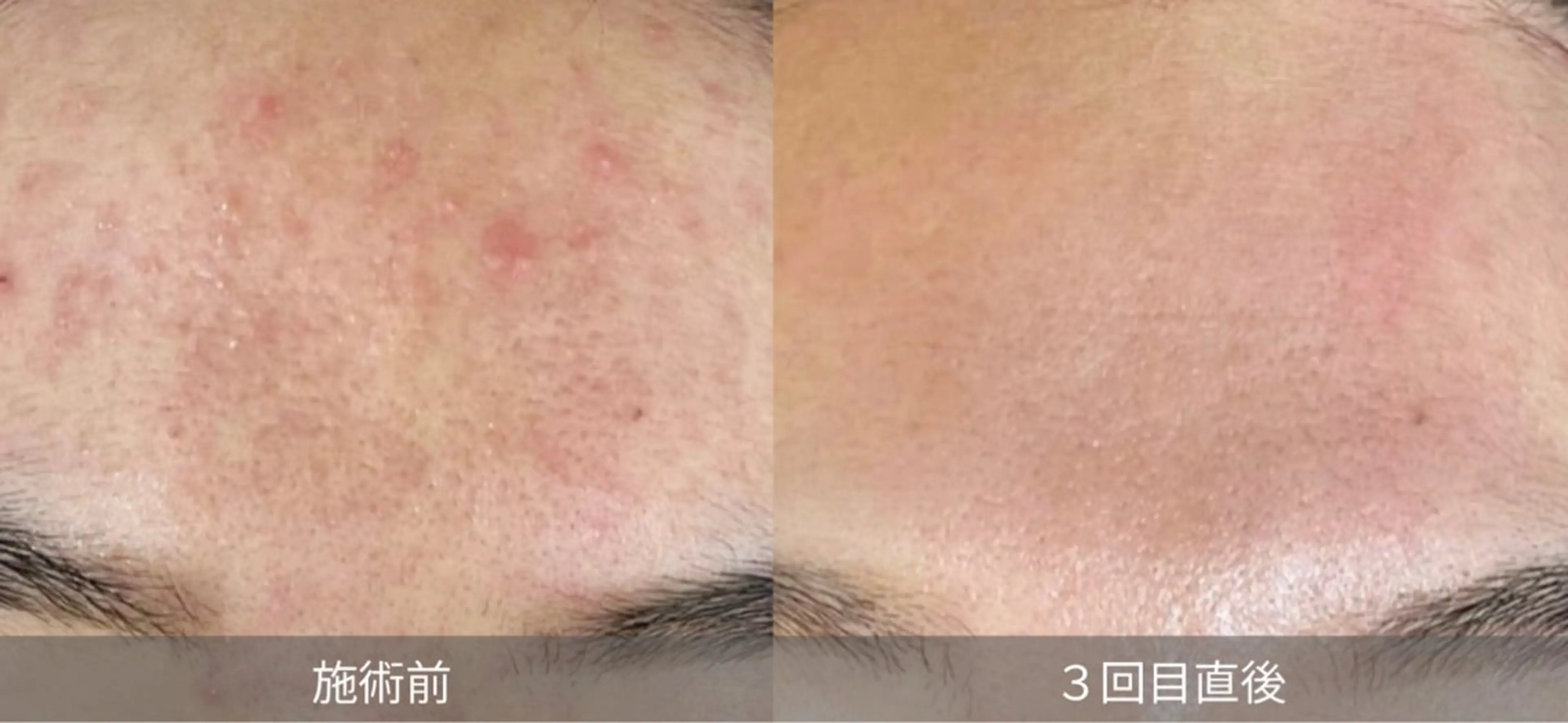 GrandAzure 大人の肌改善のエステ・リラクイメージ