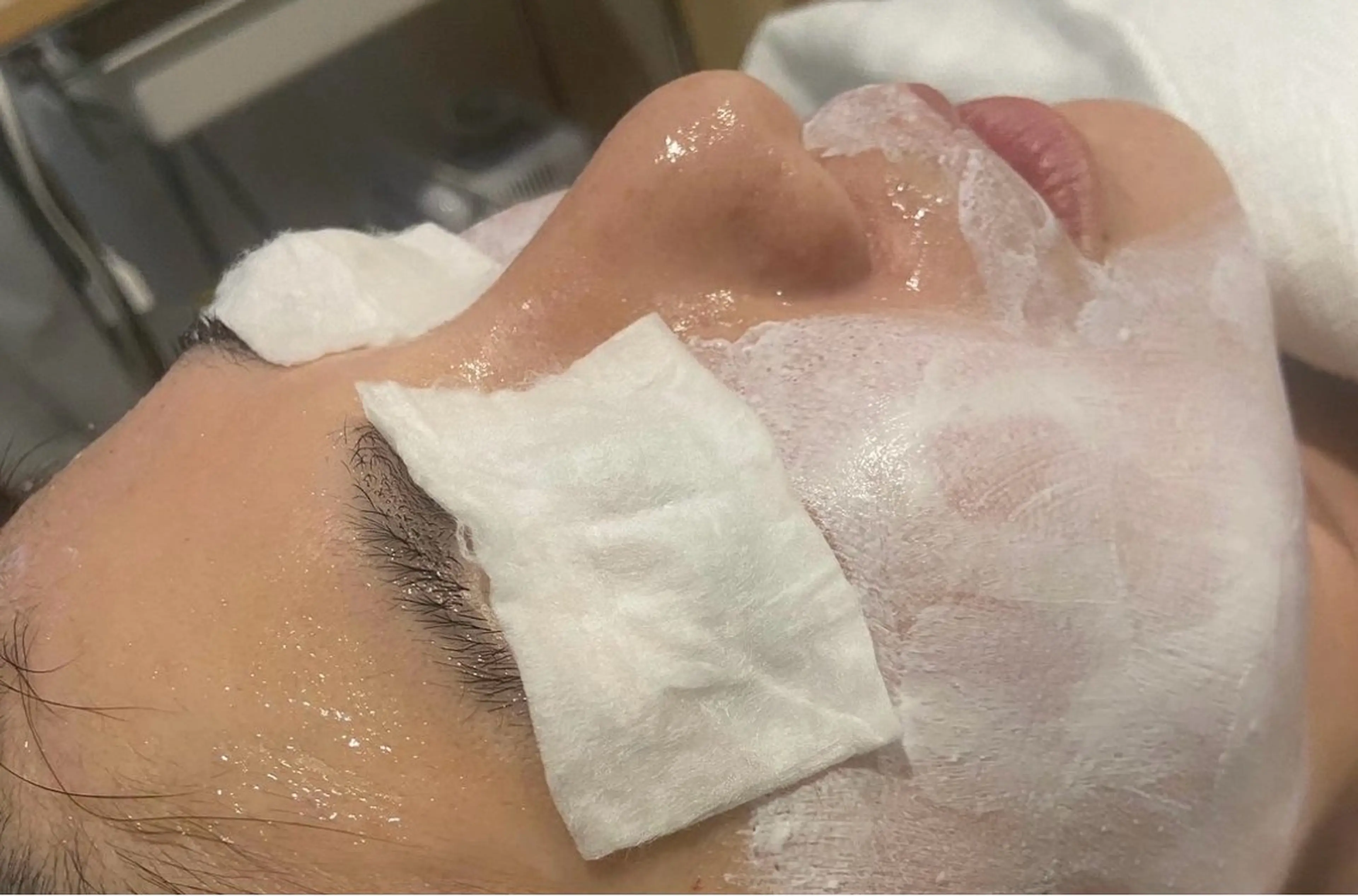 月1がおすすめ！毛穴詰まりや角質ケアならこれ！『スキンディープクレンズ』の写真