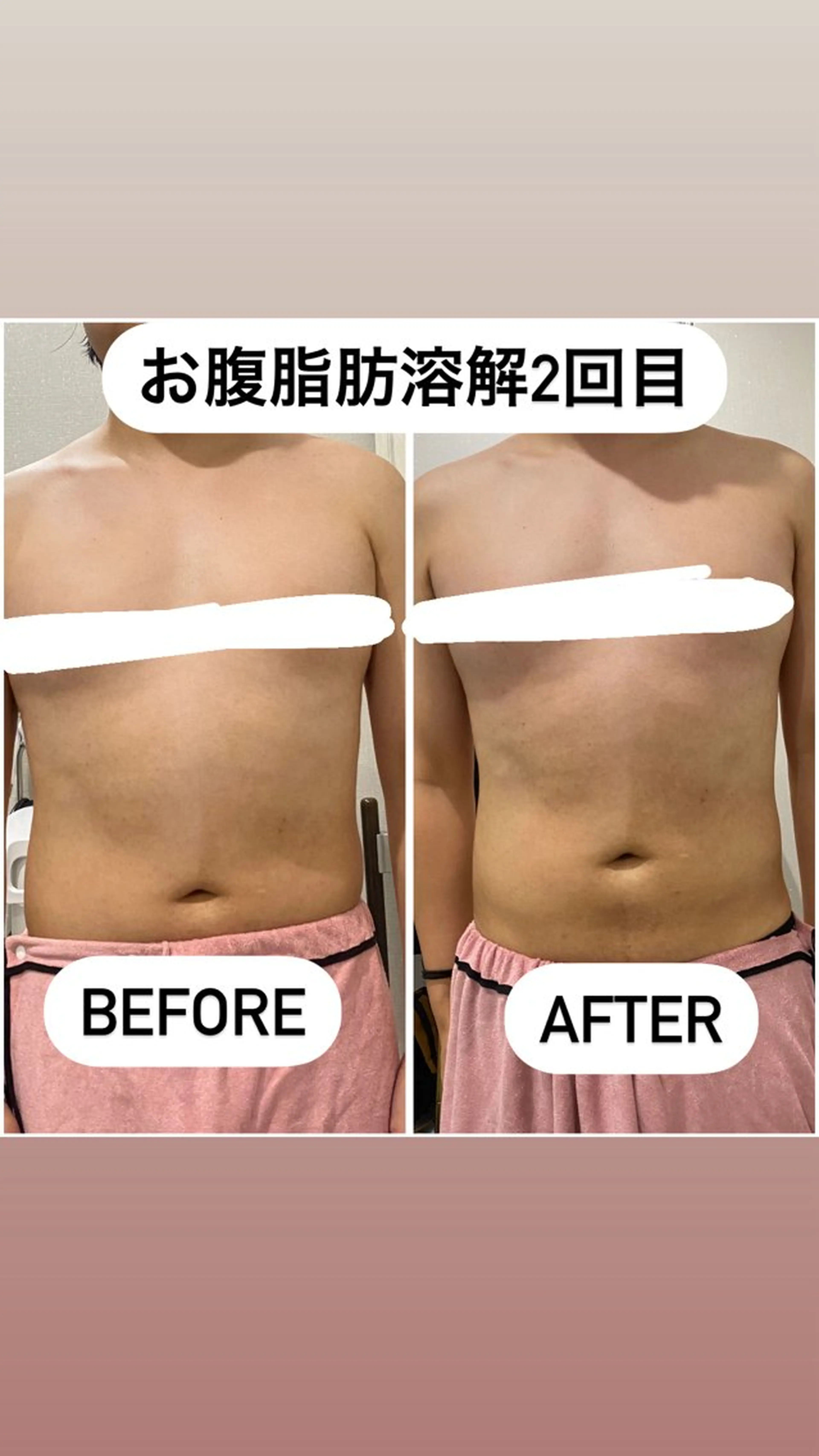 エステ 毛穴洗浄・痩身・脱毛 /アルカンジュのエステ・リラクイメージ