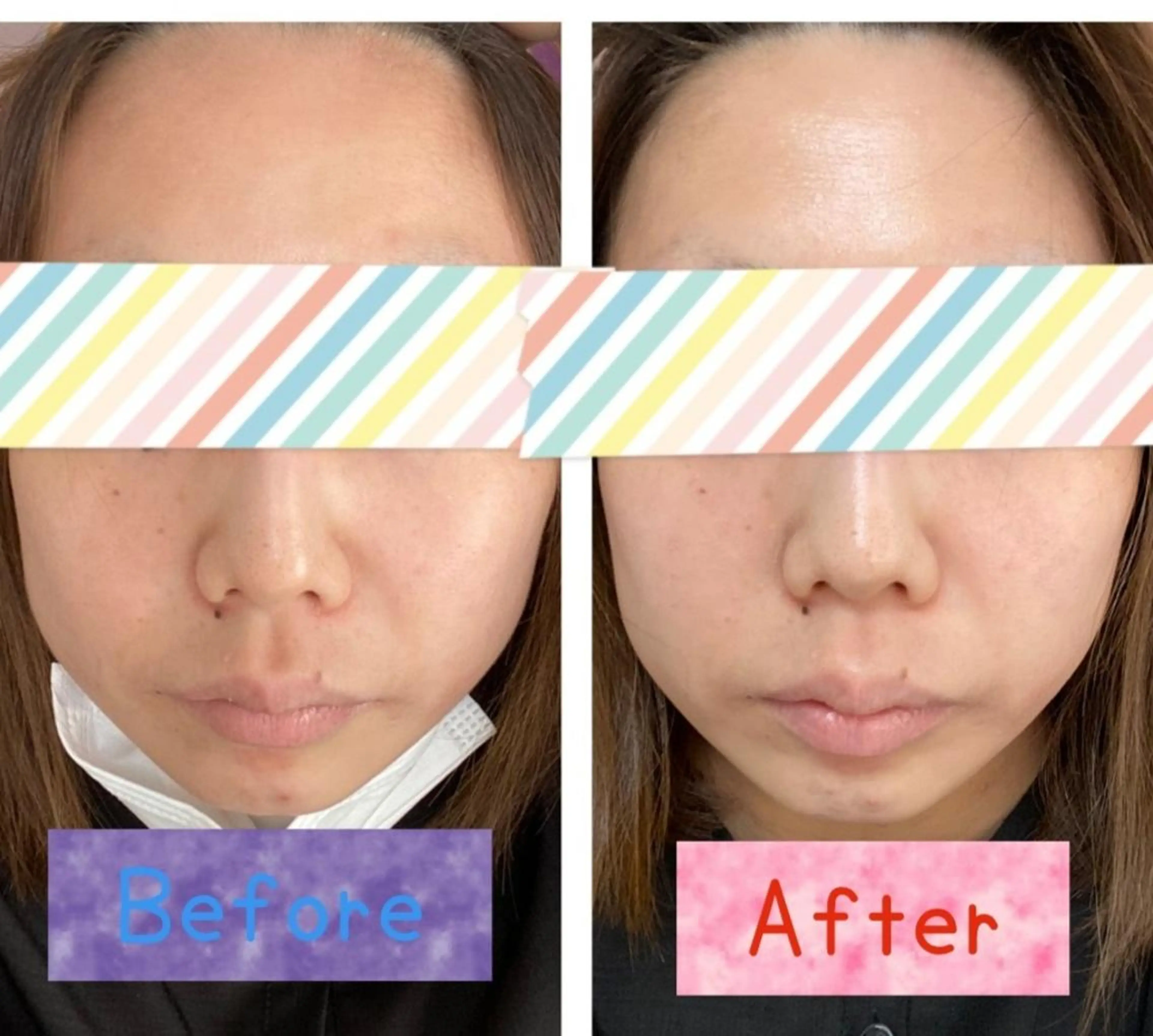 エステ いとう なおみのエステ・リラクイメージ