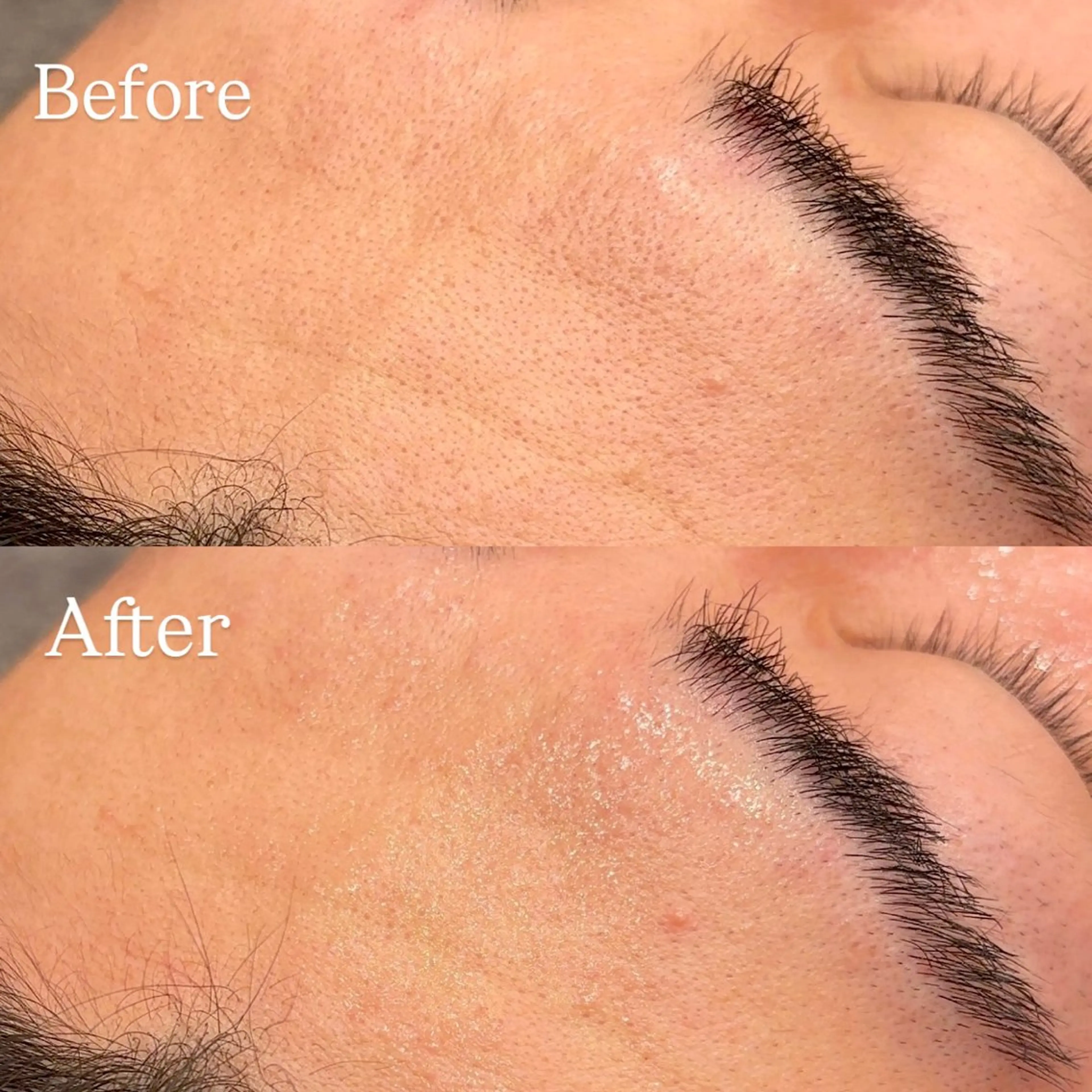 Hari Lounge恵比寿所属・chika🦋 ハリラウンジ恵比寿のエステ・リラクイメージ