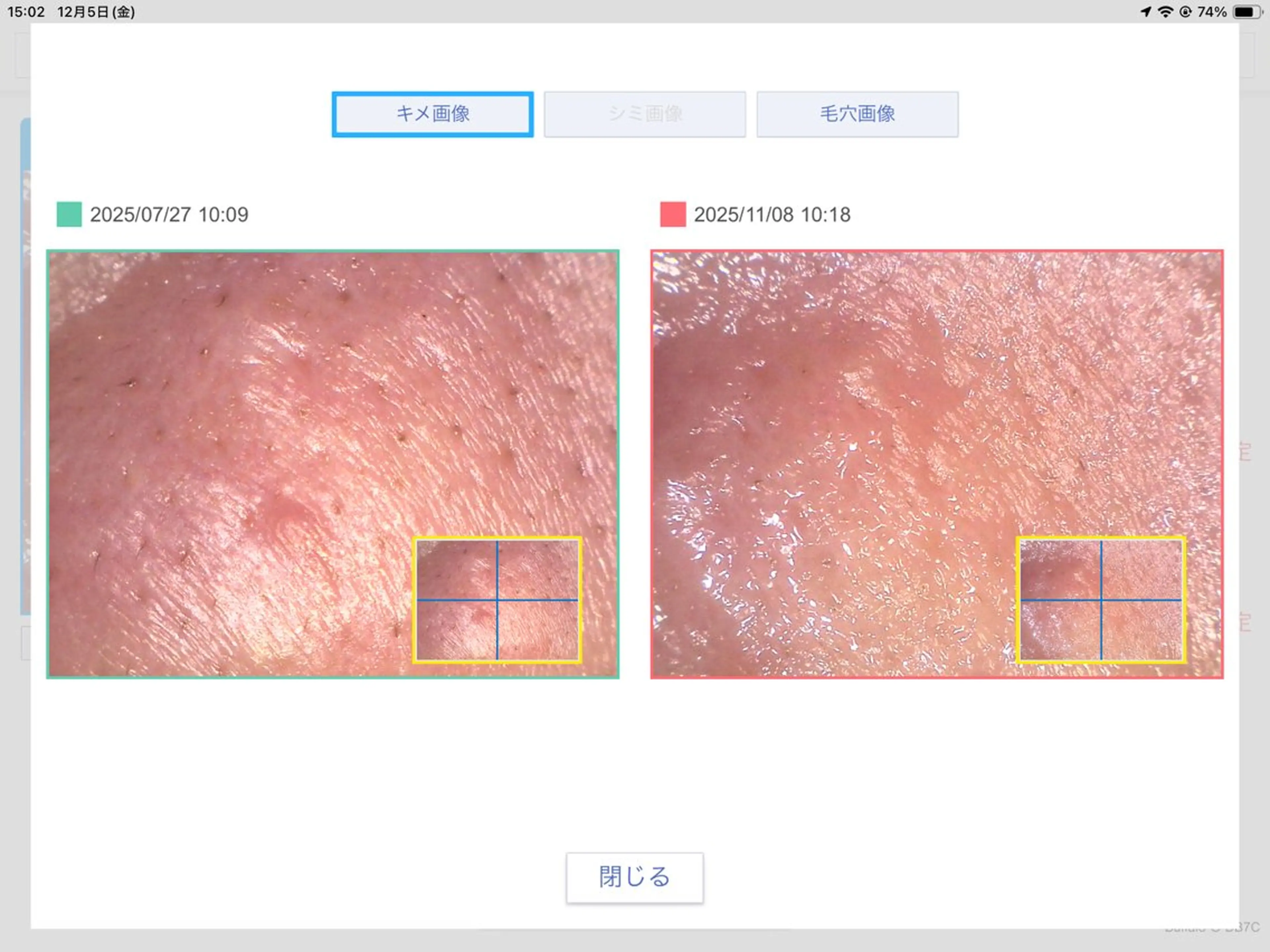 エステ 毛穴専門店Bébéもりの里店所属・毛穴専門店Bébé もりの里店のエステ・リラクイメージ