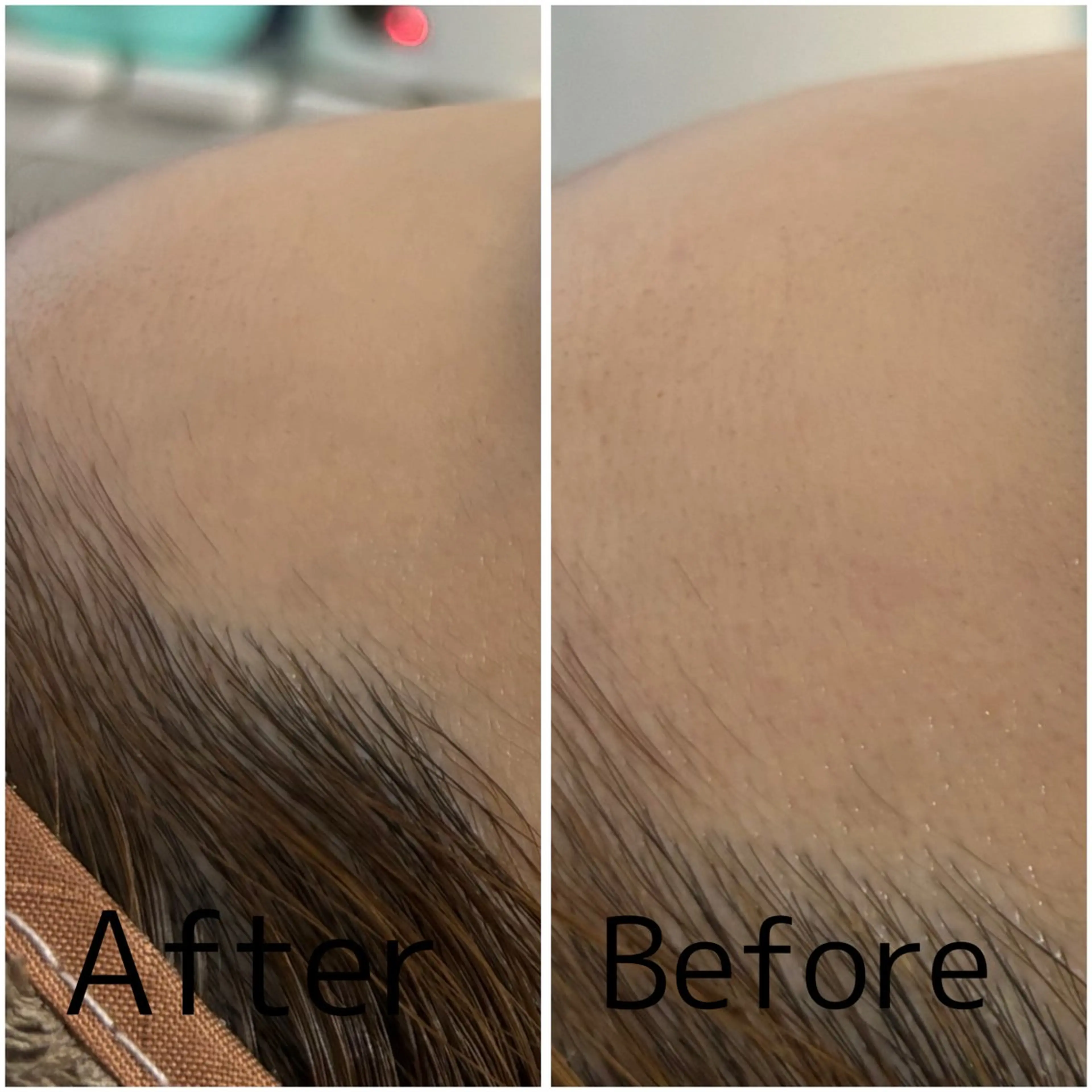 エステ 【敏感肌管理×小顔サロン】Belle orchid所属・東三国/新大阪 敏感肌×小顔サロンのエステ・リラクイメージ