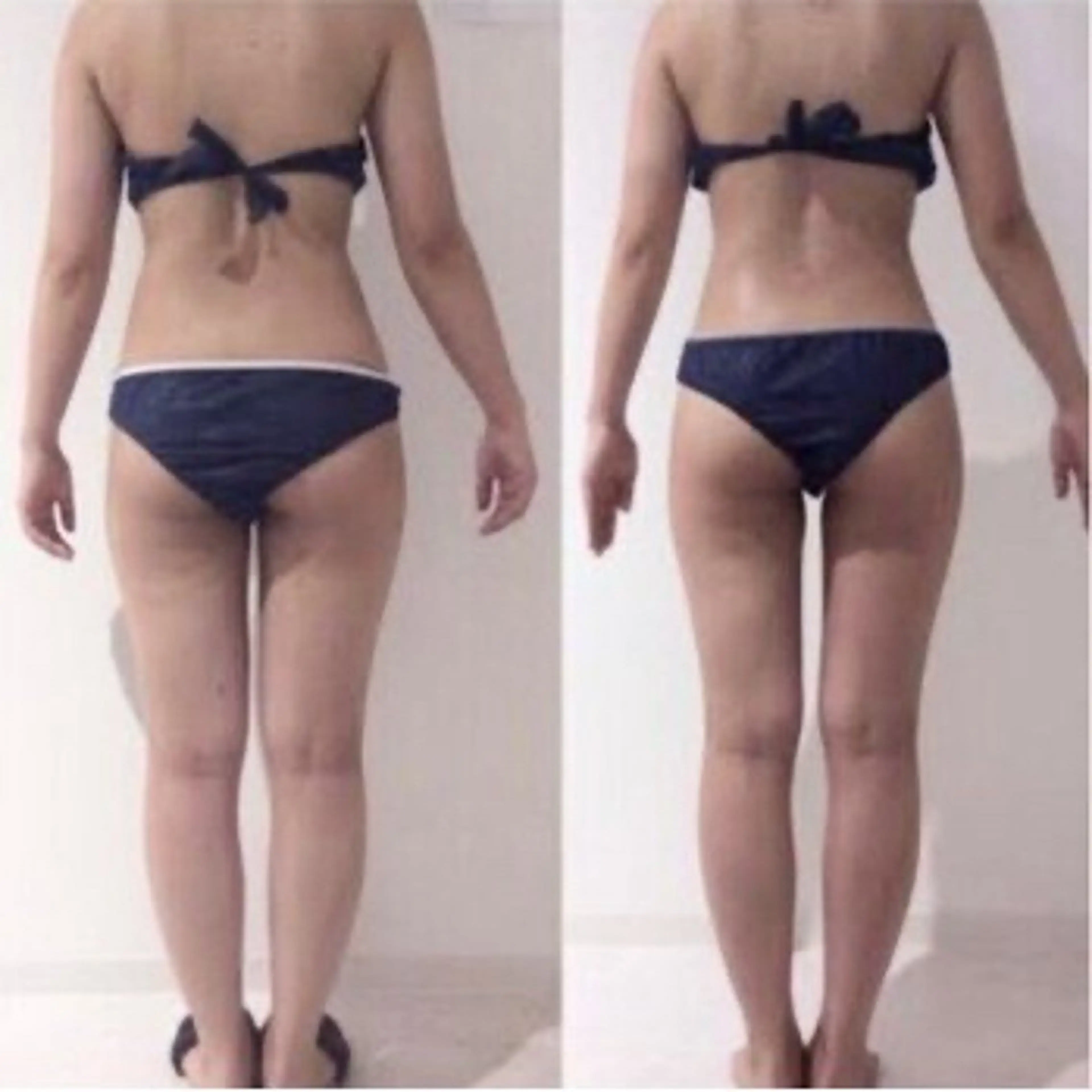 【人気No.1】痩せない原因は腸かも？腸活×痩身90分の写真