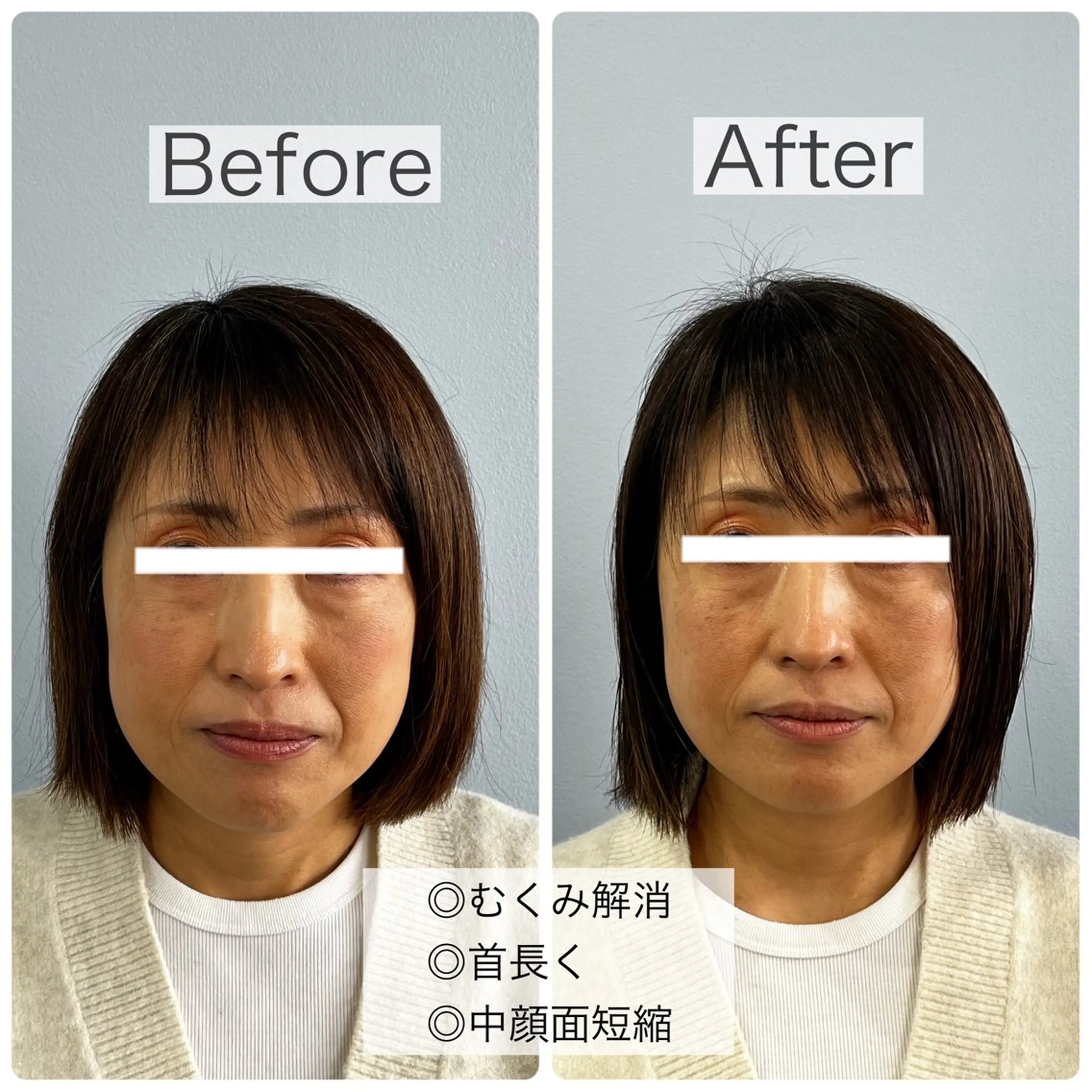 GAGA D  Ash所属・GAGA D Ashのヘアスタイル