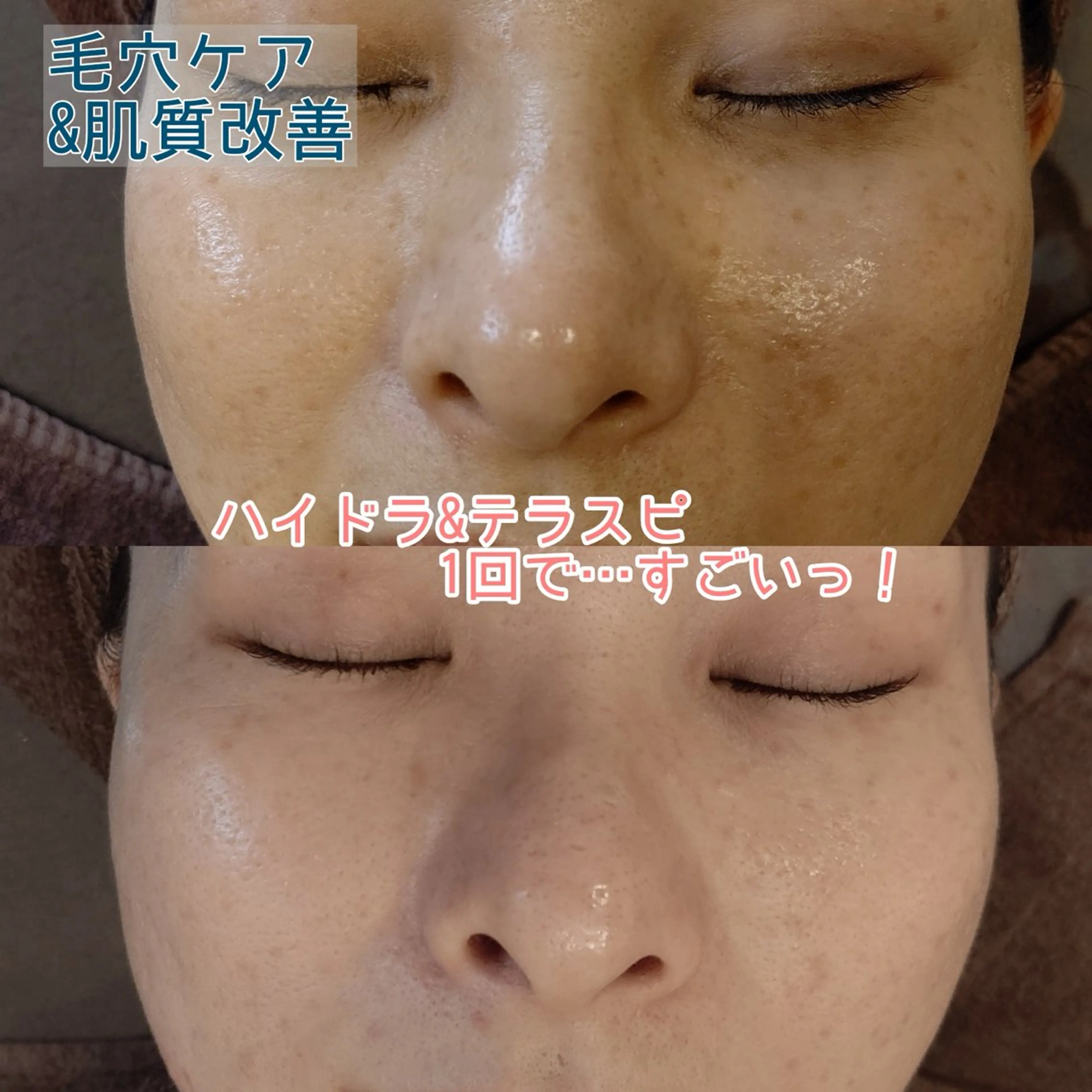 エステ vary  clue MISAのエステ・リラクイメージ