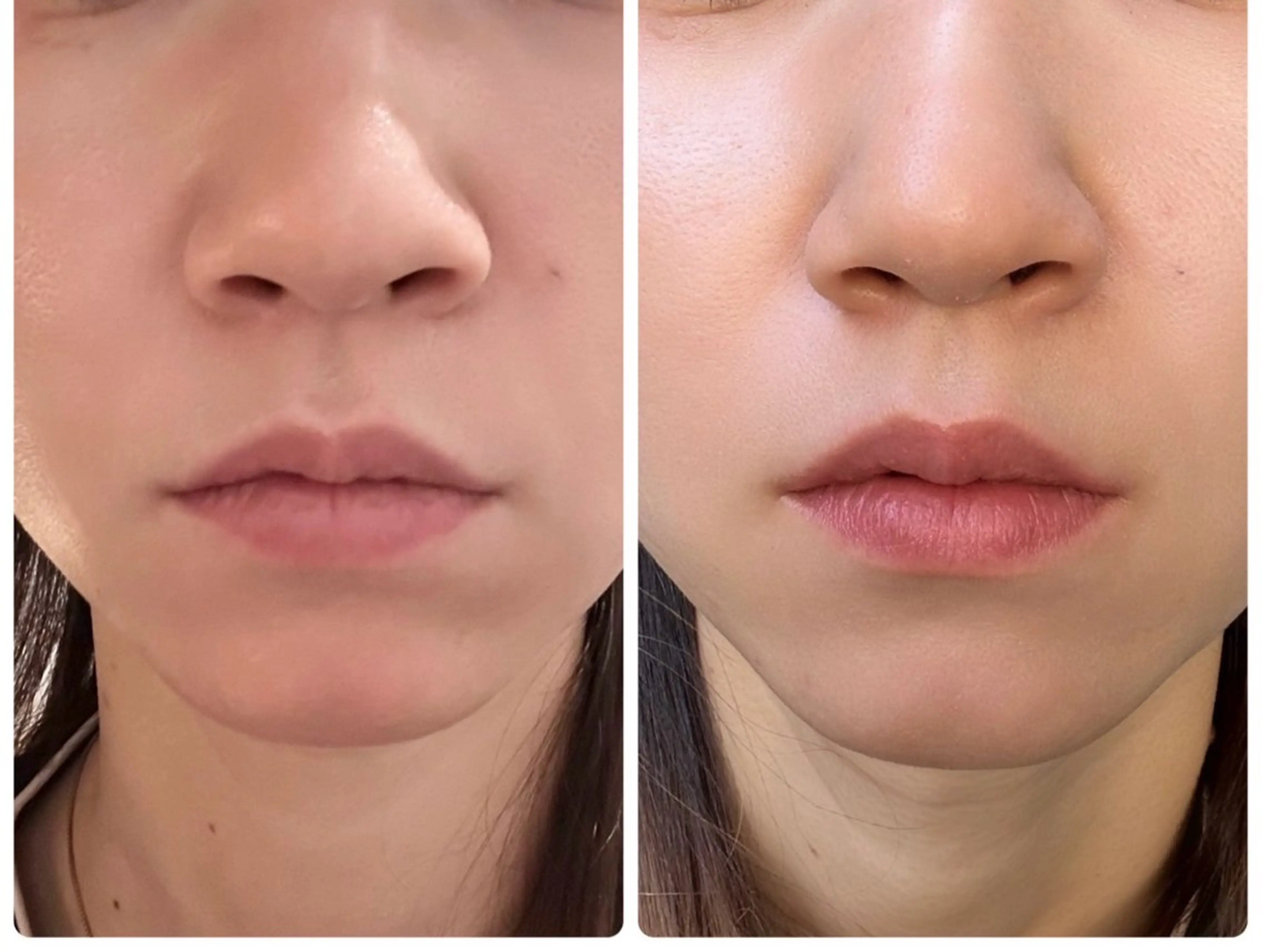 小顔/たるみ/黒ずみ除去専門サロン/SONA 大和西大寺店所属・【小顔専門看護師 サロンSONA】のエステ・リラクイメージ