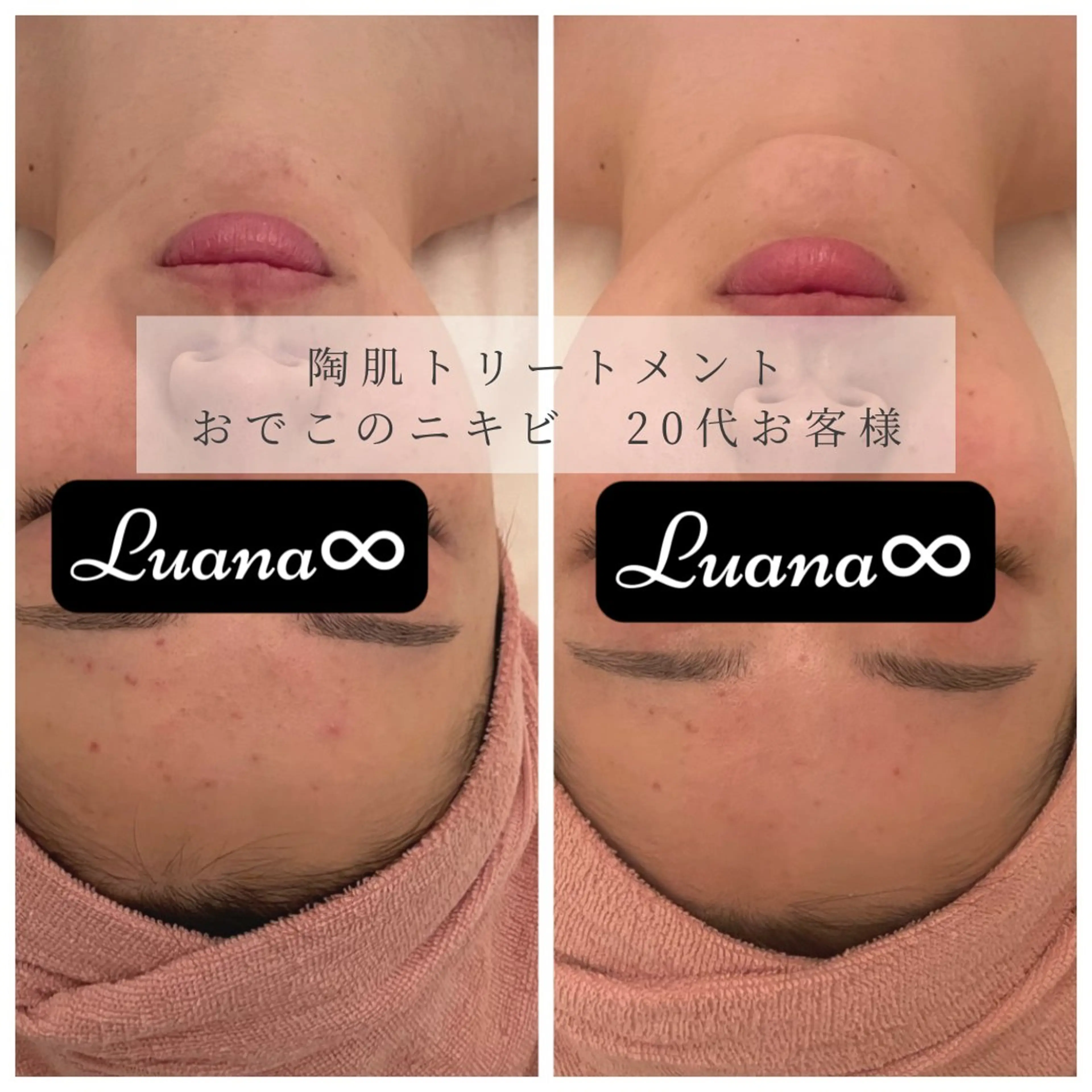 Luana ∞のエステ・リラクイメージ