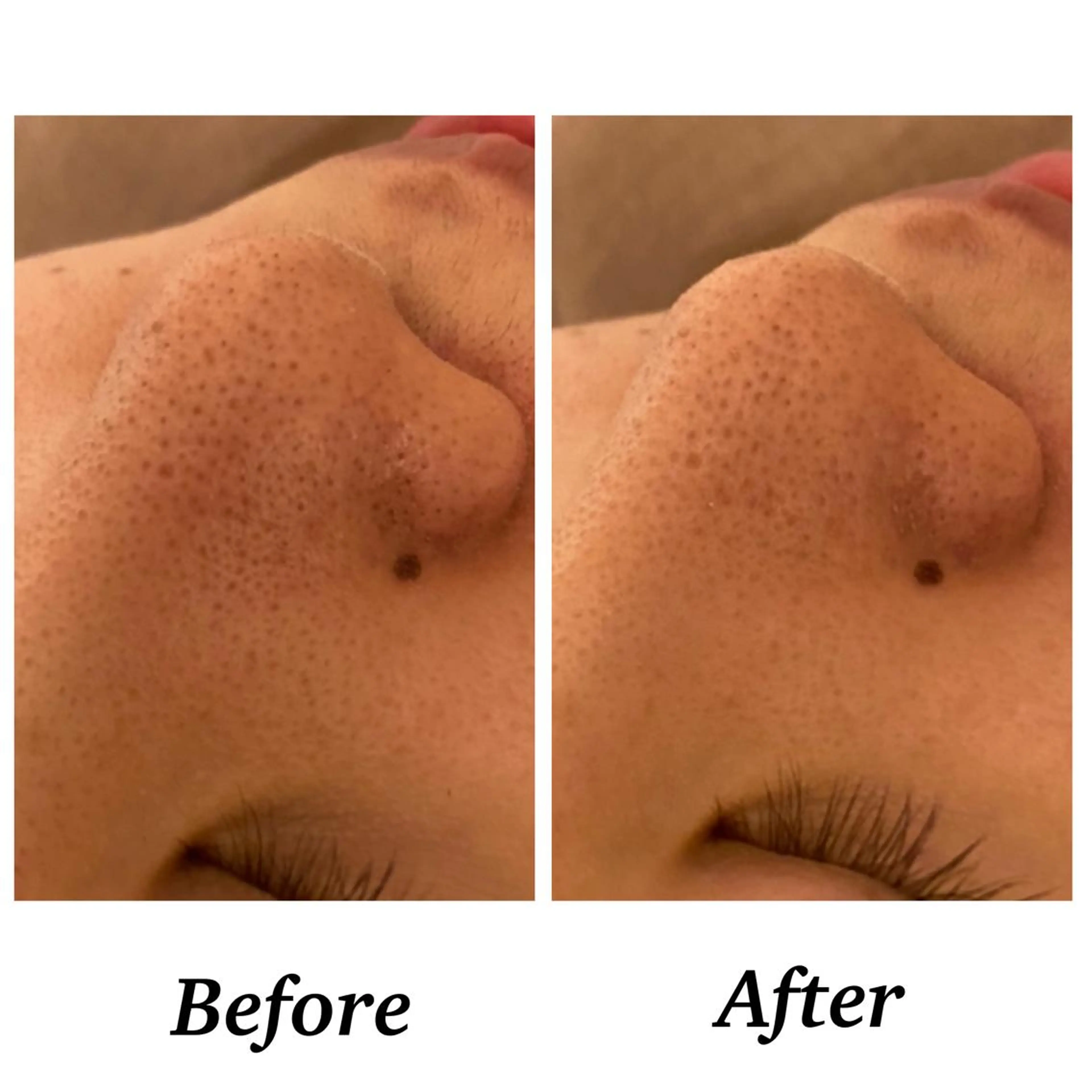 エステ リラク Bellesthe (ベルエステ)のエステ・リラクイメージ