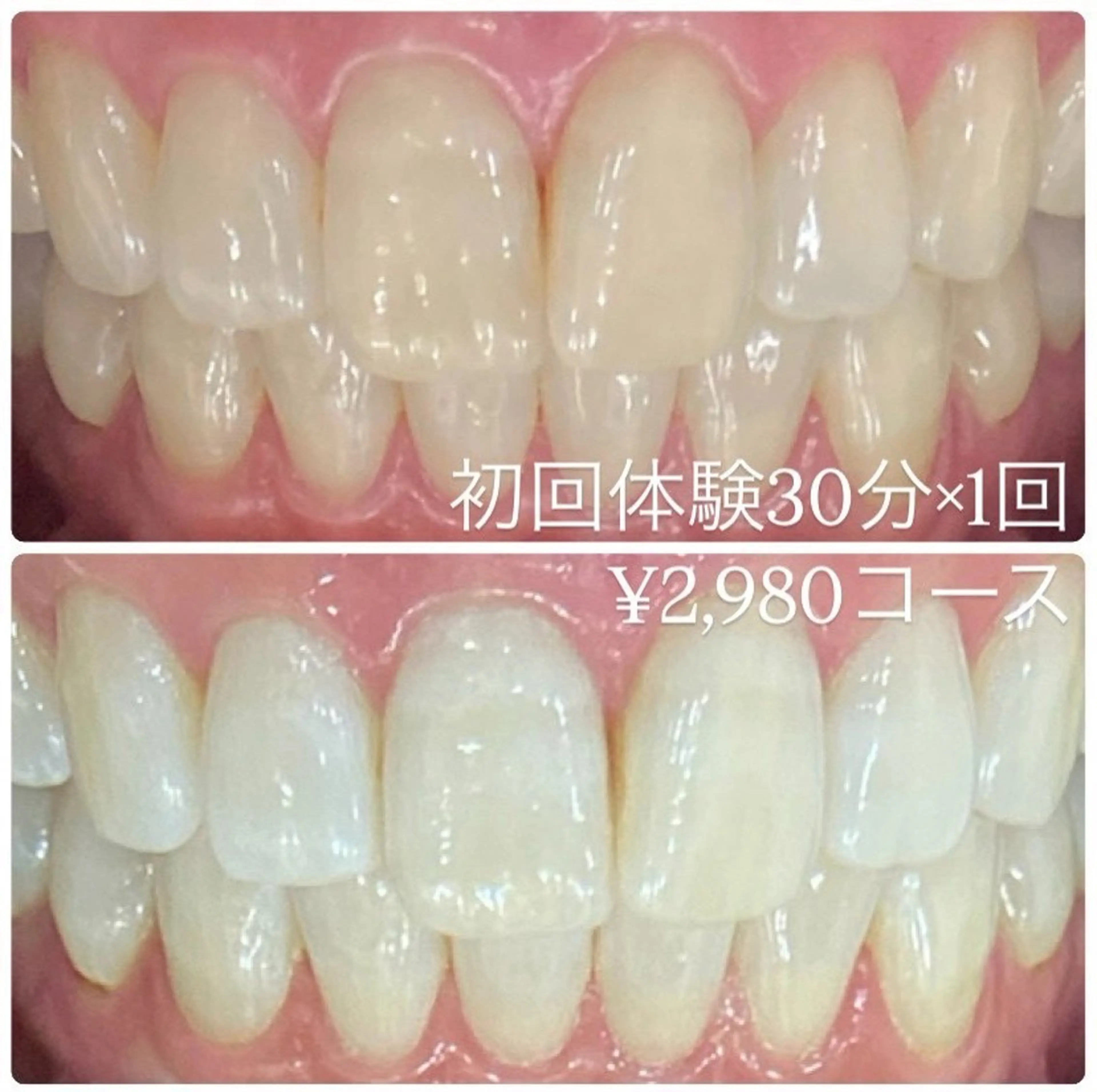 メンズ その他 ホワイトニングルーム　川崎店所属・ホワイトニング ルーム　川崎店のその他イメージ