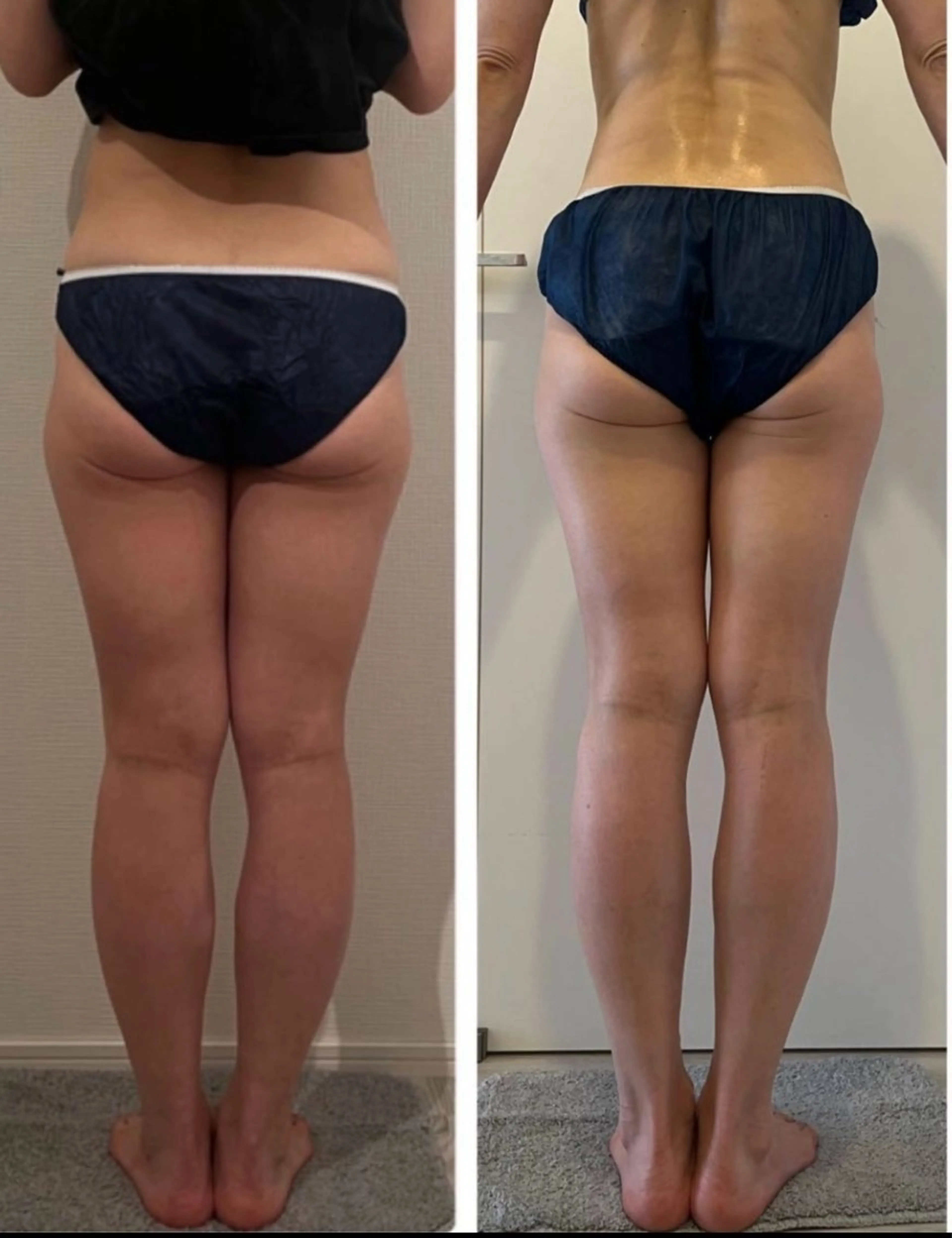 M.plus  エムプリュ所属・よもぎ蒸し、セル撃退 専門店M.plusのエステ・リラクイメージ