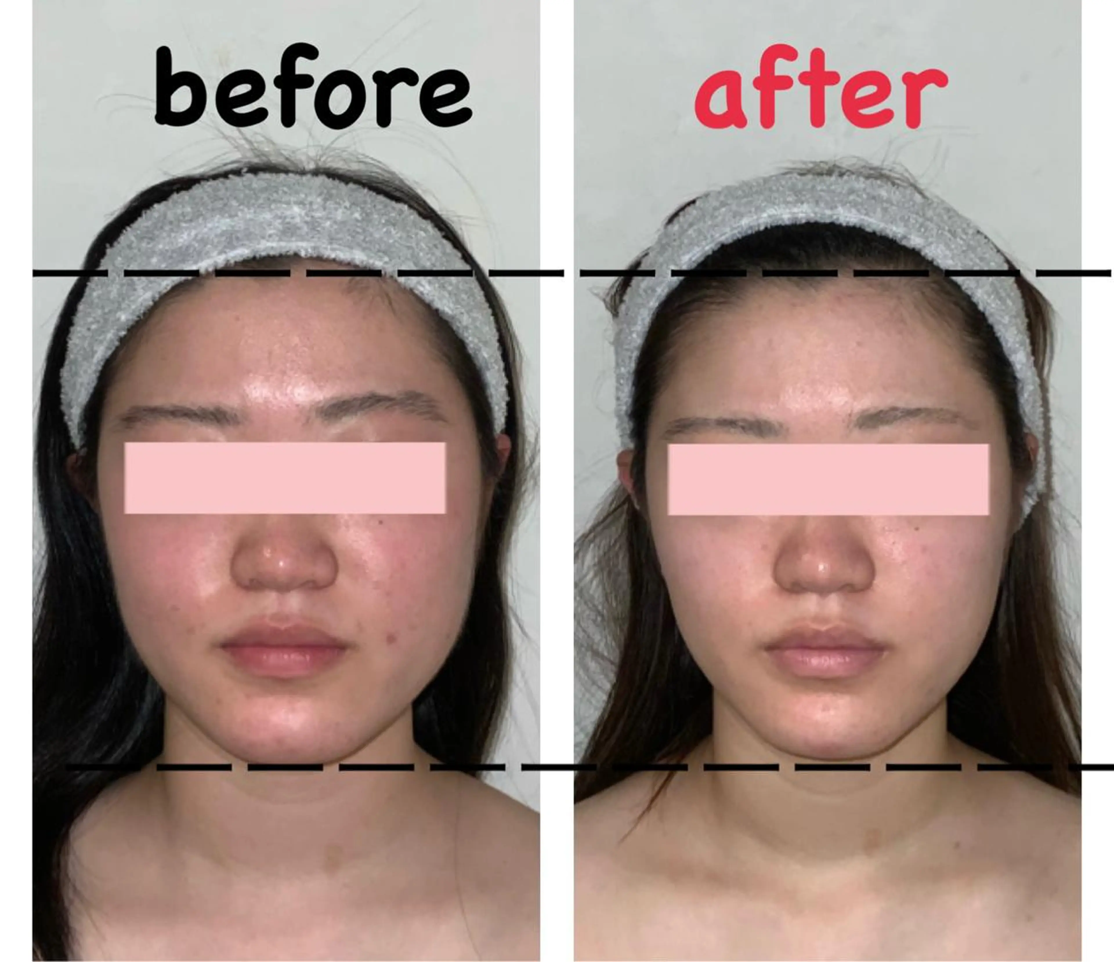 ≪初回限定💛グーグル口コミ投稿約束価格≫　小顔整体コルギ＋悩み別オプション　70分5800円→0円の写真