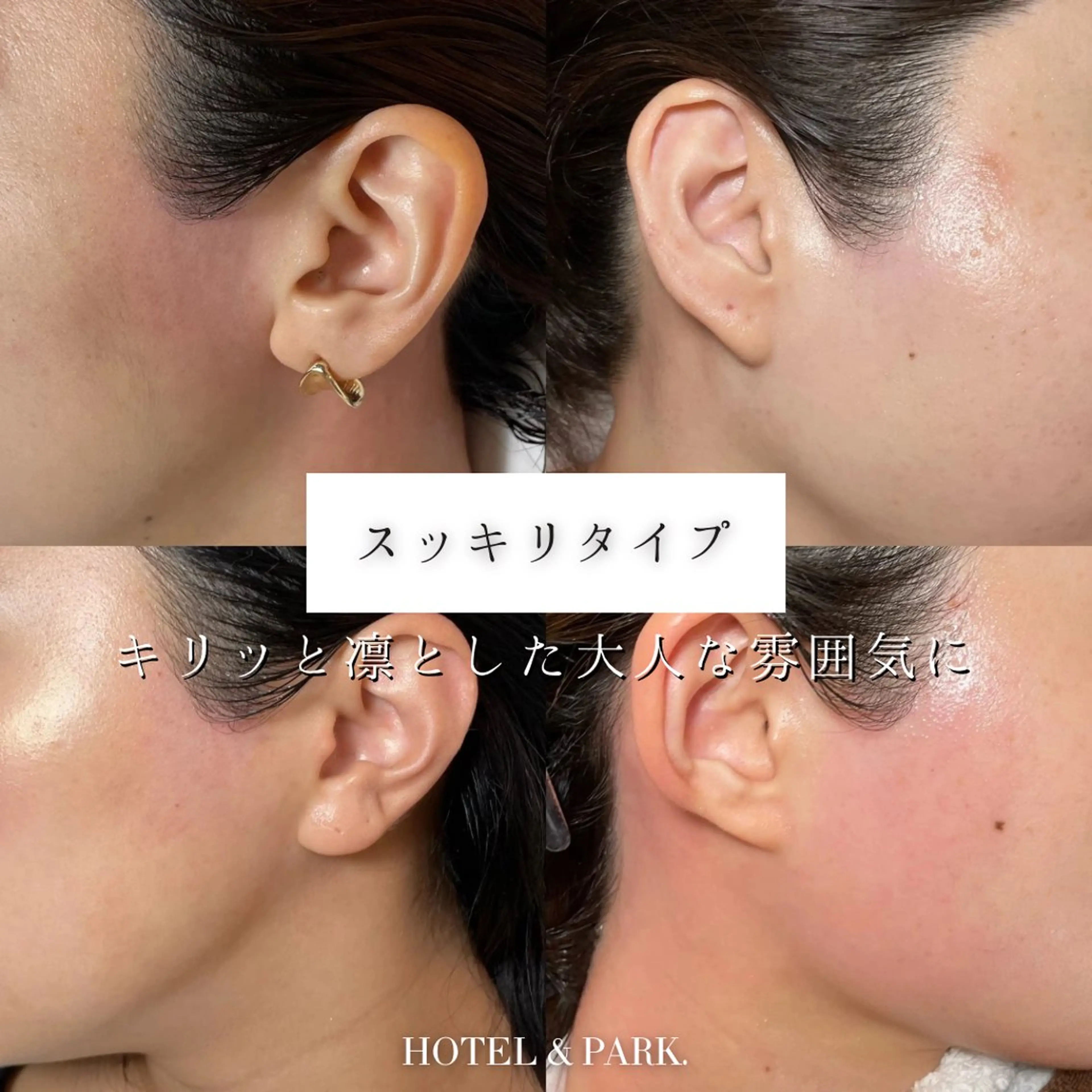 脱毛 HOTEL&PARK . ワックス脱毛のエステ・リラクイメージ