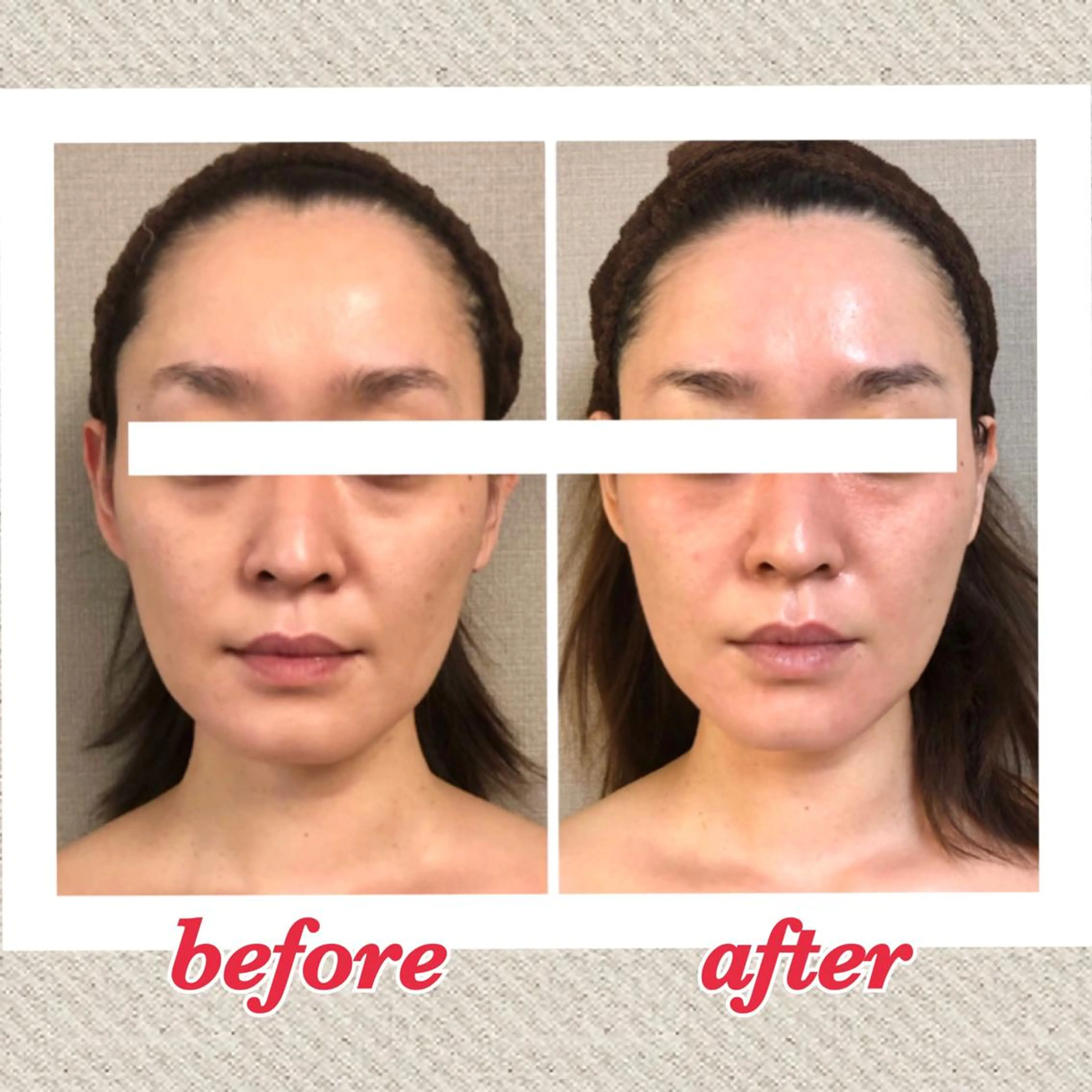 エステ リラク 美ola ビオラのエステ・リラクイメージ