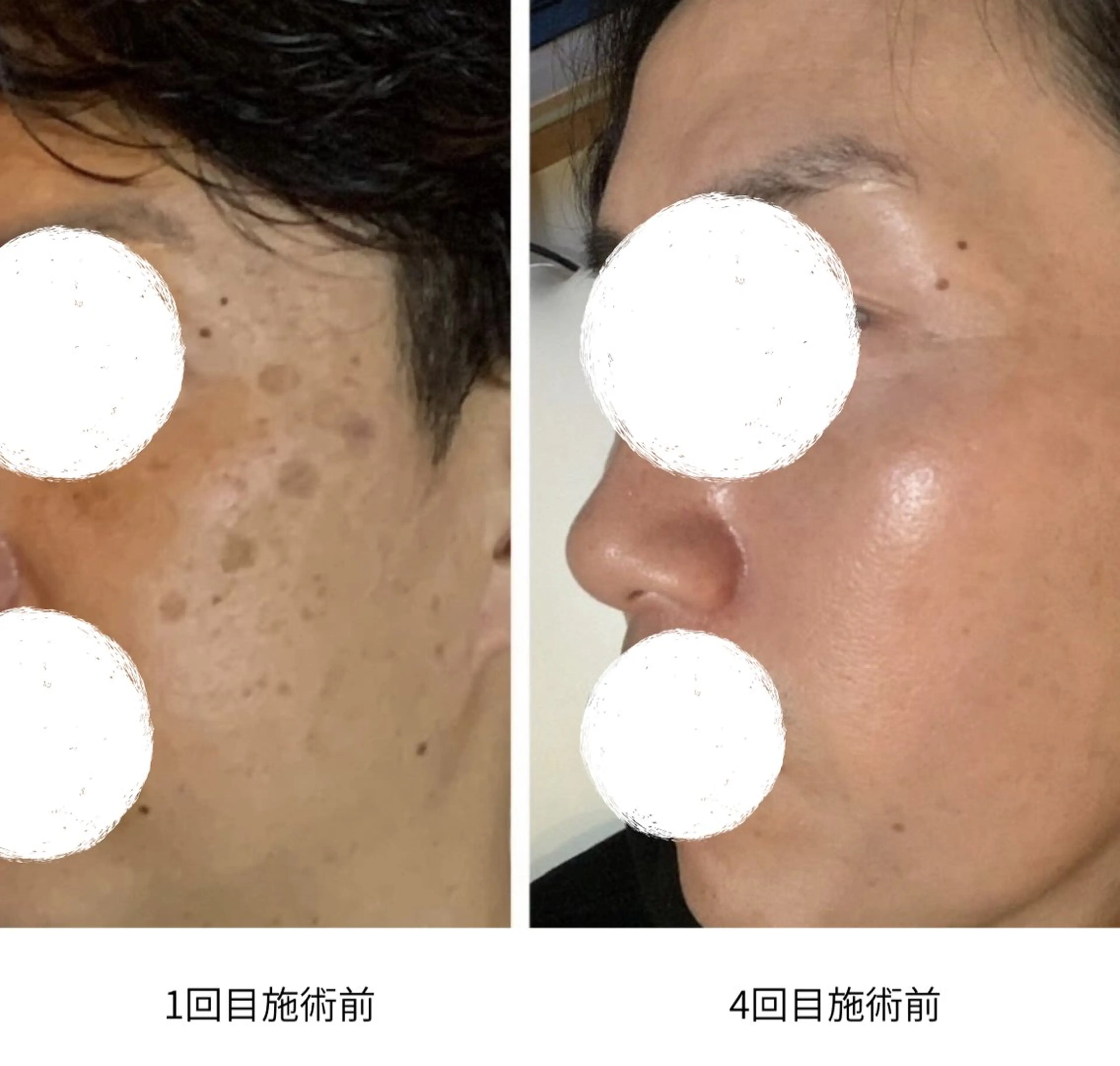 スリーエスプラス内　美肌サロンEme所属・希映 -kieのエステ・リラクイメージ