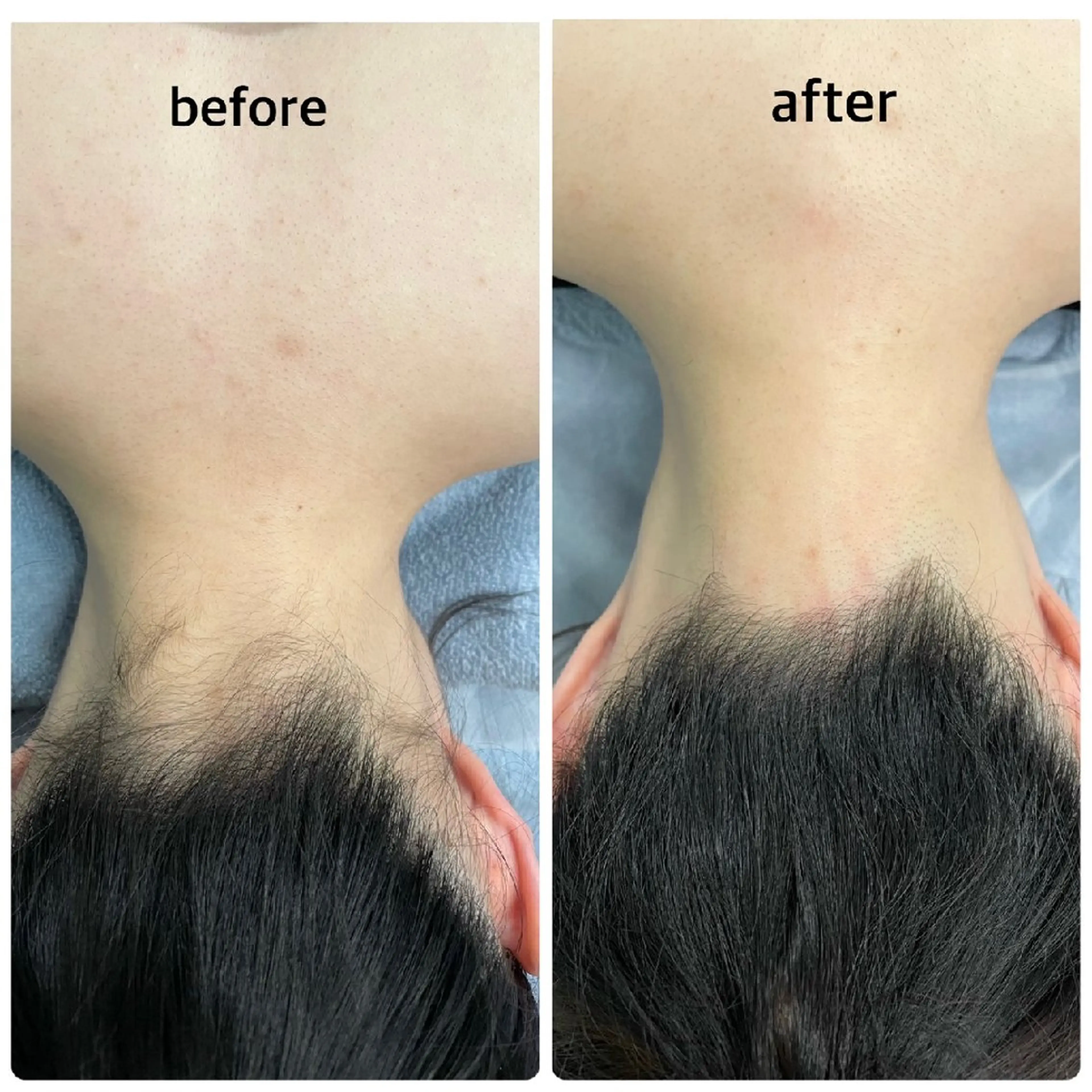 脱毛 ulu-fu所属・脱毛ulu-fu 植村のエステ・リラクイメージ