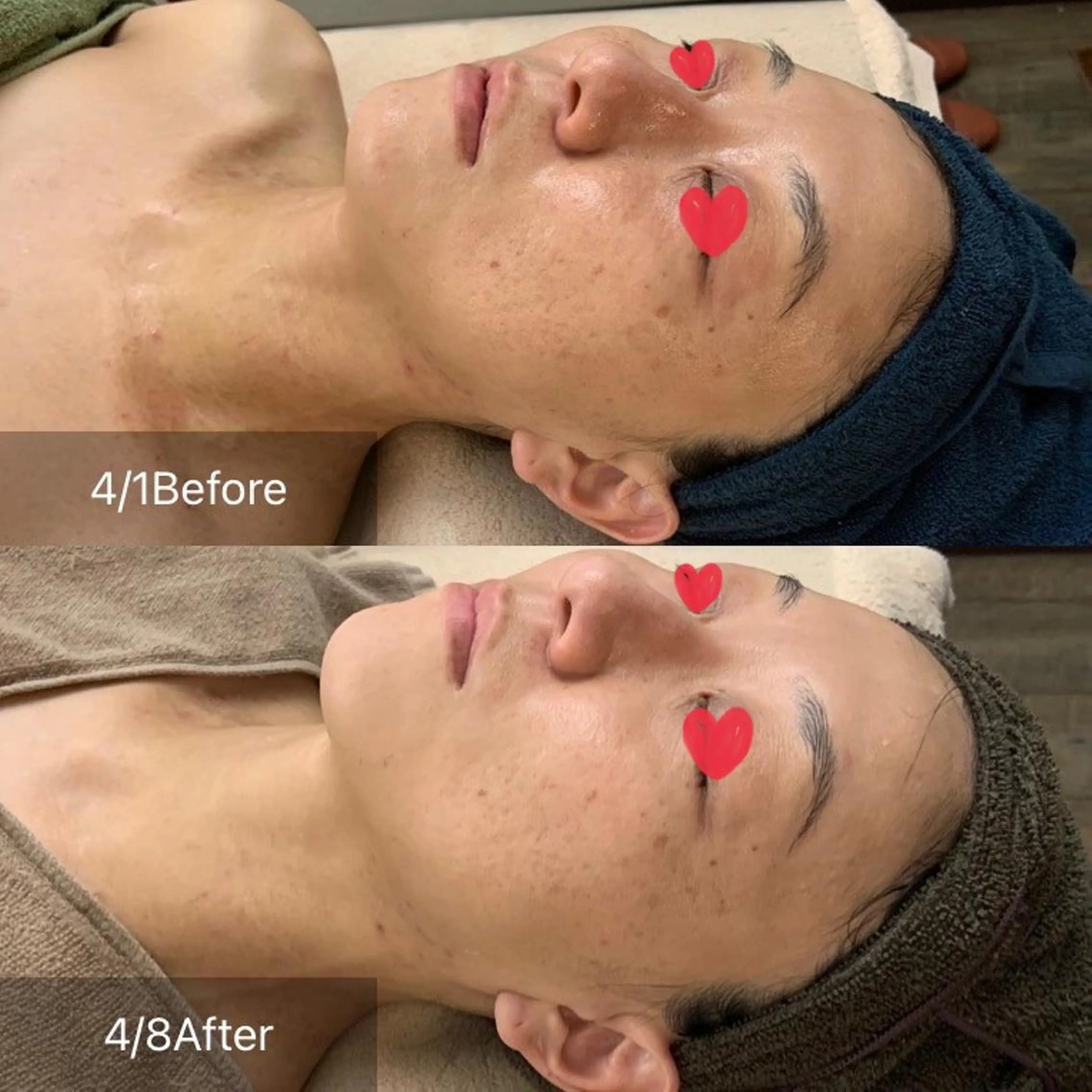 エステ 肌改善専門 浦和美園のエステ・リラクイメージ