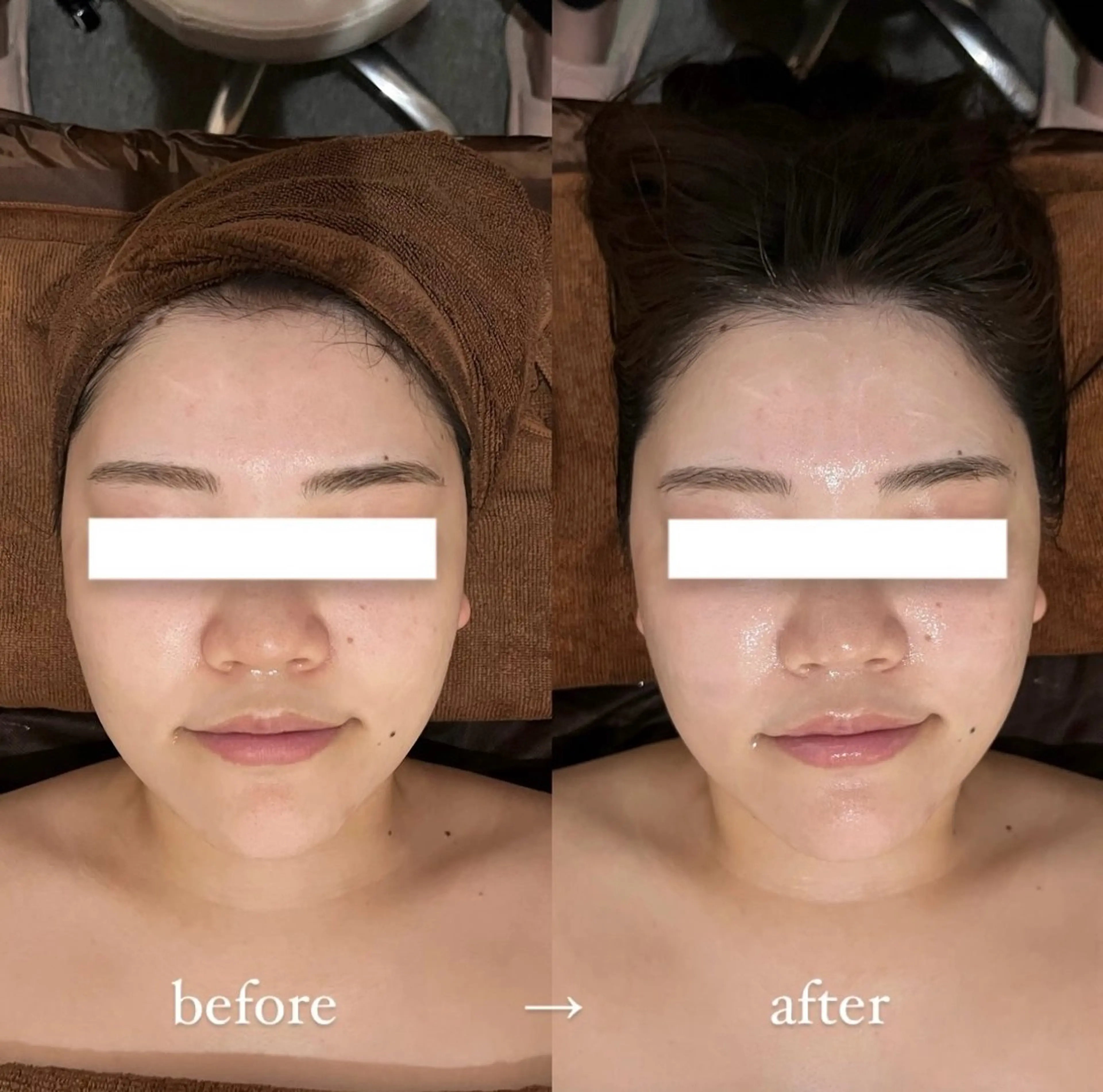 NOEL所属・フェイシャルエステ Utaiのエステ・リラクイメージ